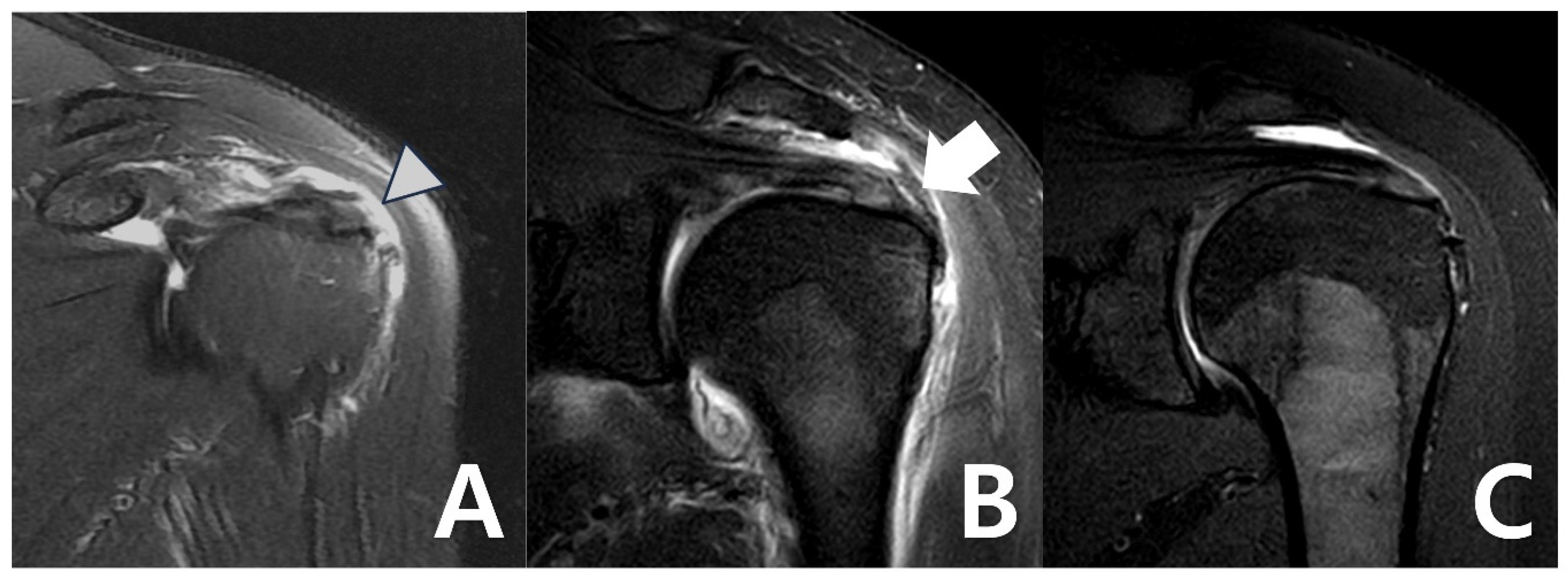Medicina 61 00988 g003