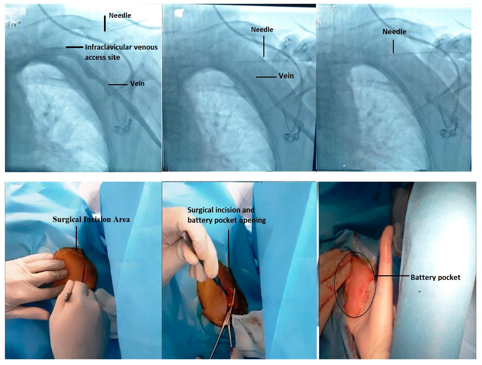 Medicina 61 01001 g005