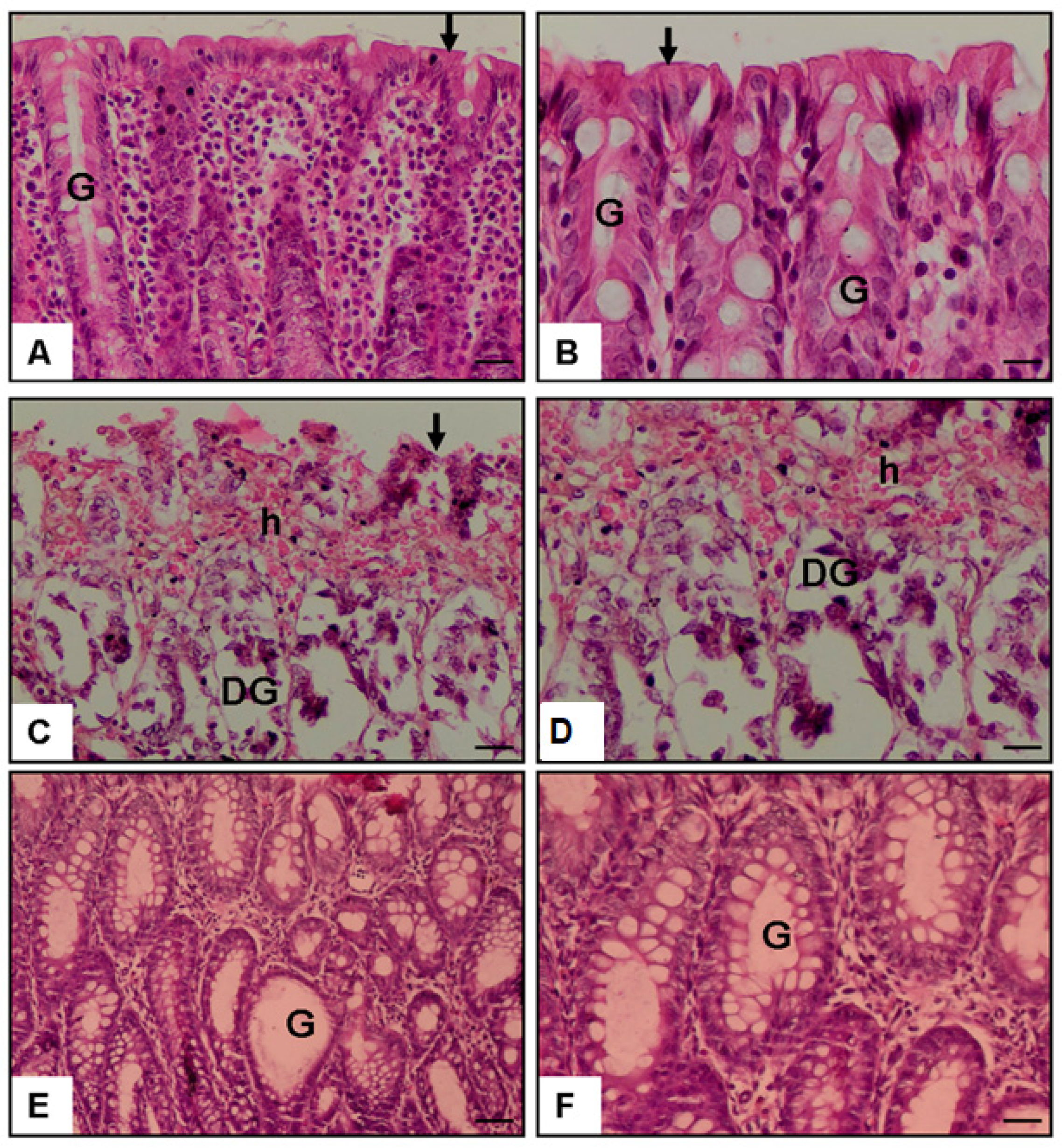 Medicina 61 01033 g003