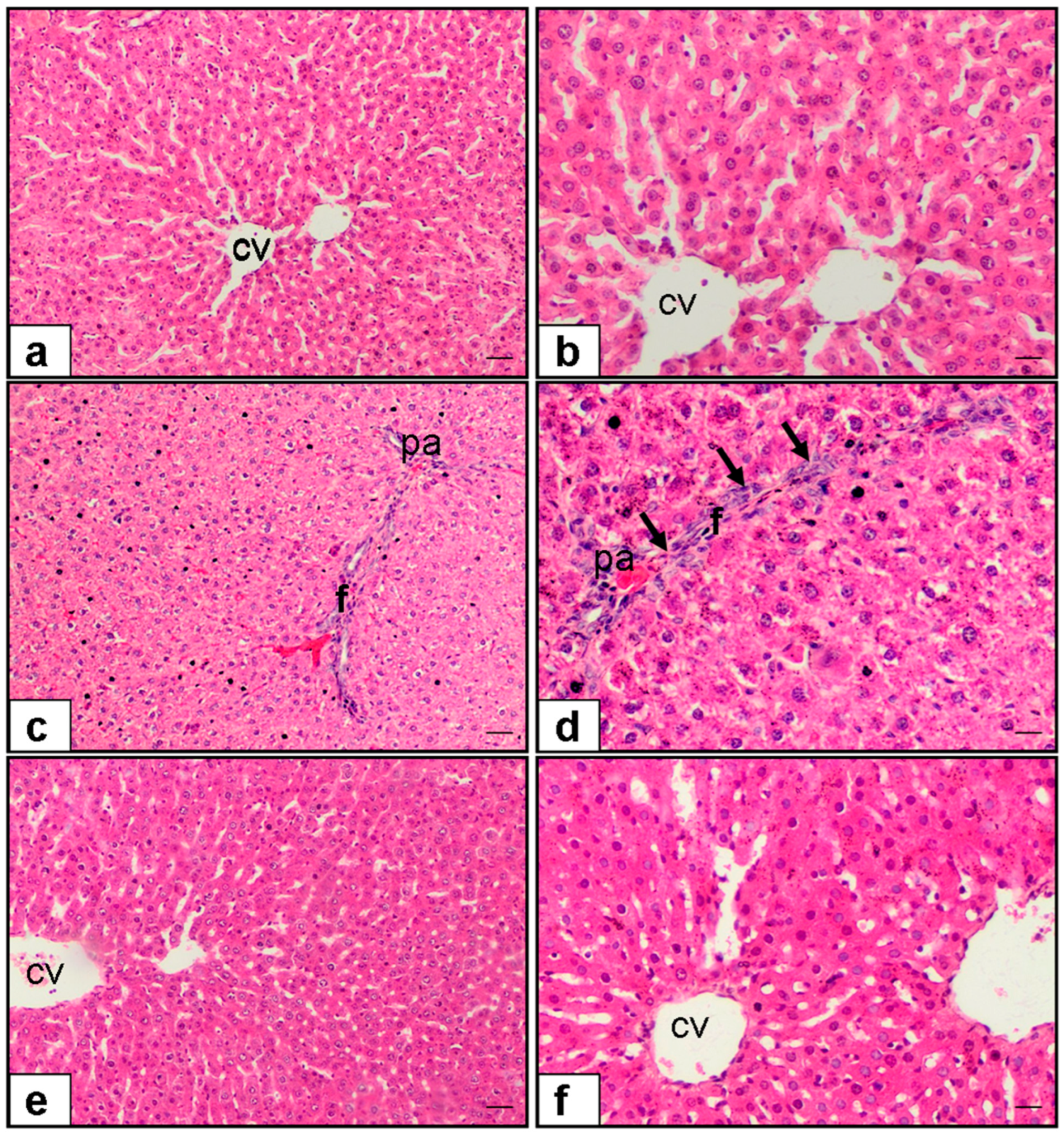 Medicina 61 01036 g003