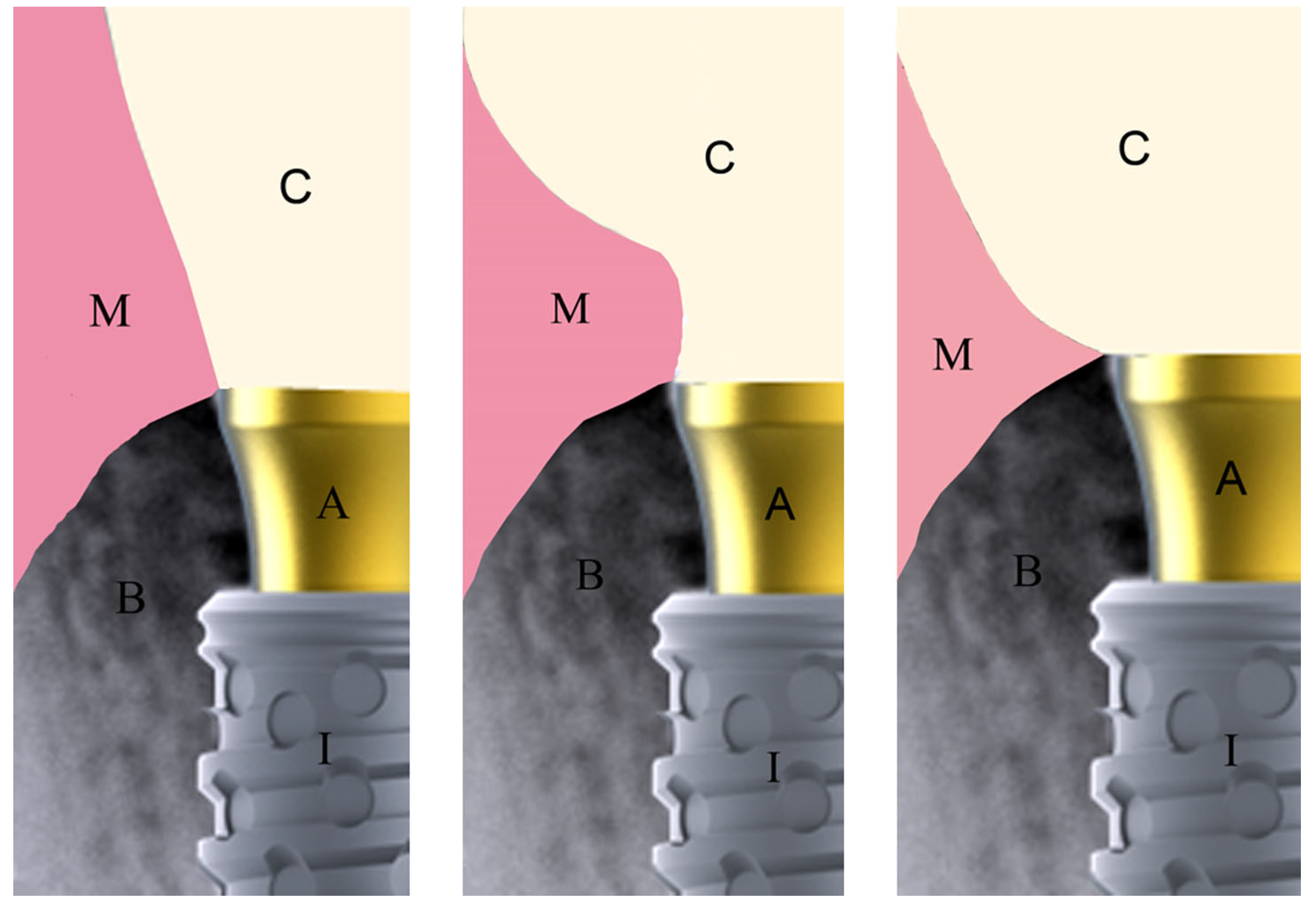Medicina 61 01041 g001