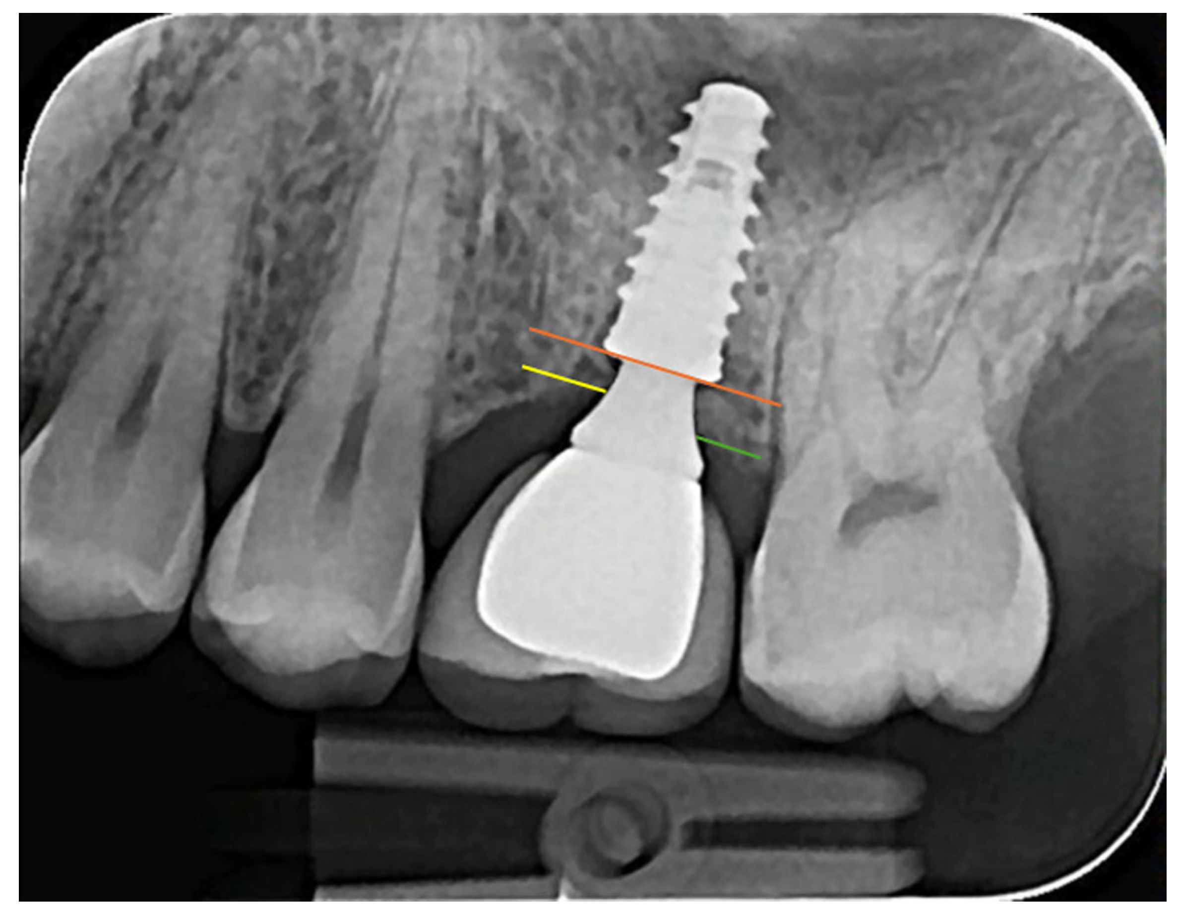 Medicina 61 01041 g003