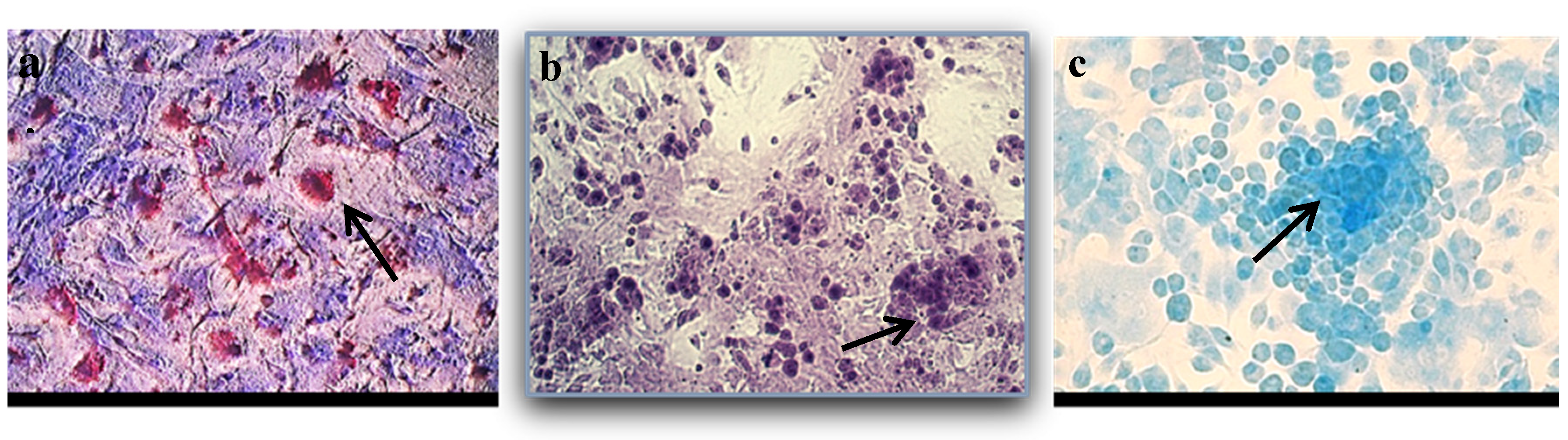 Medicina 61 01042 g002