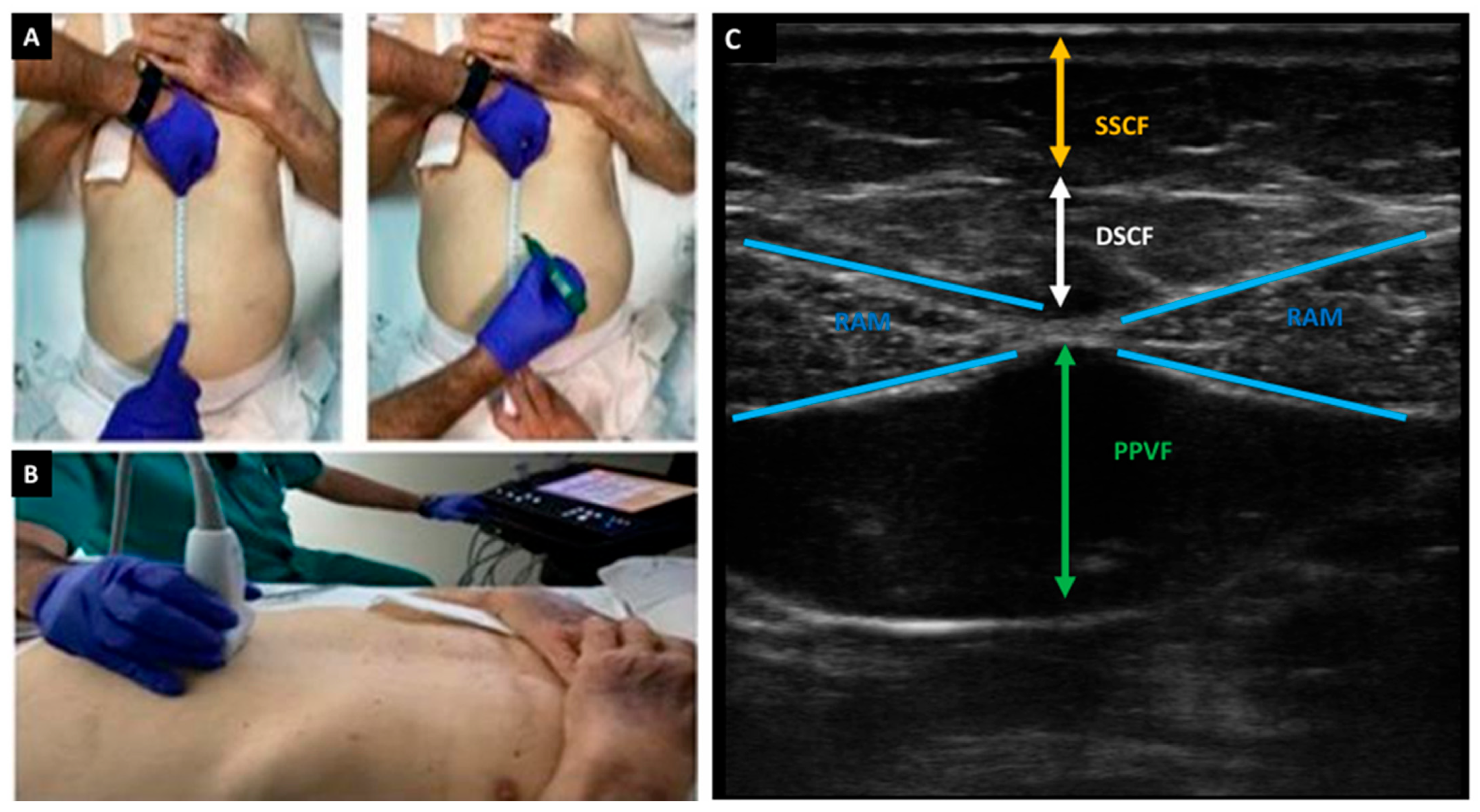 Medicina 61 01044 g002