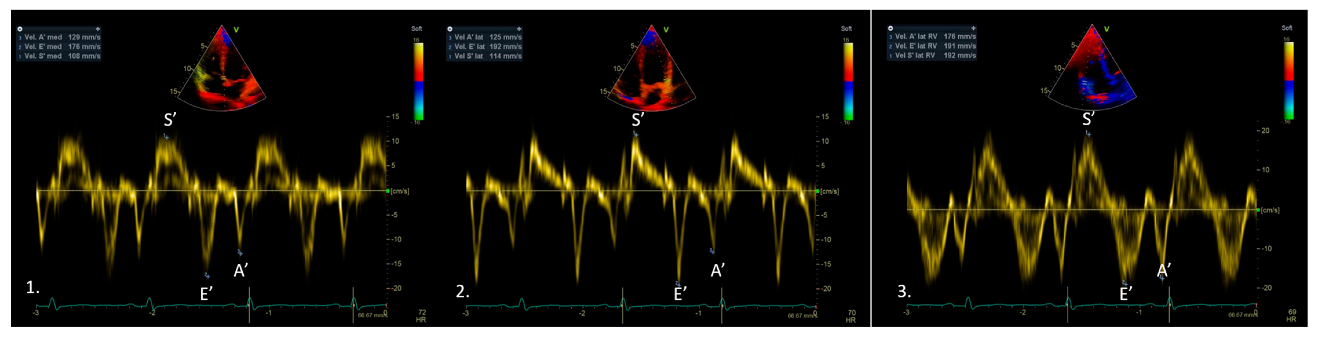 Medicina 61 01051 g001
