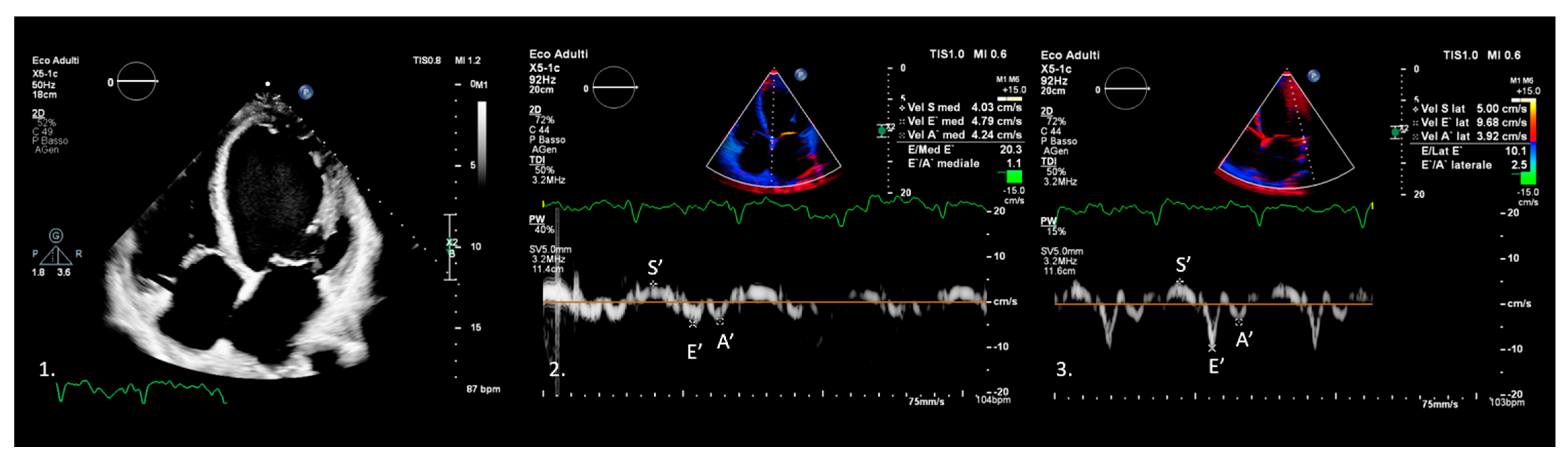 Medicina 61 01051 g002