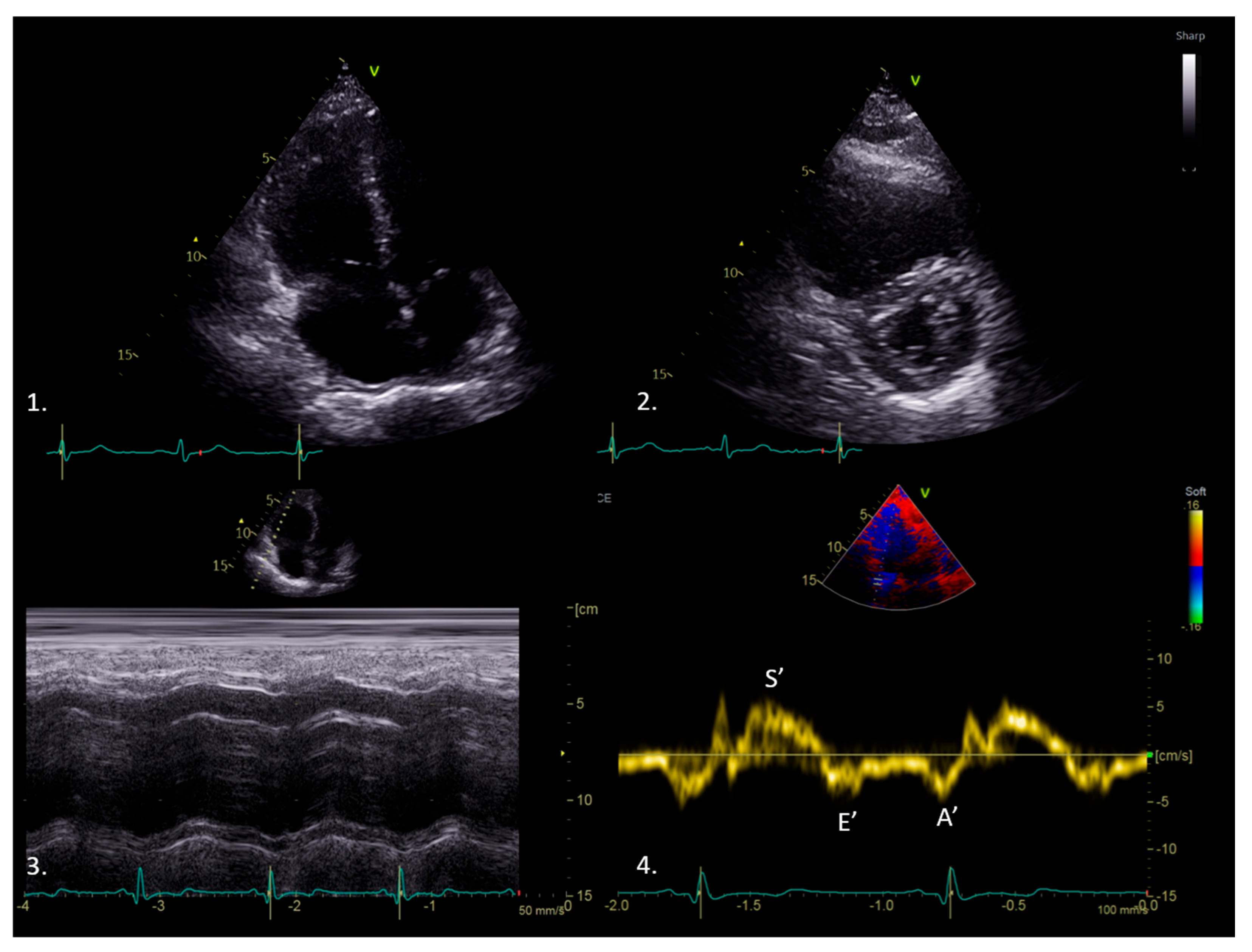 Medicina 61 01051 g003