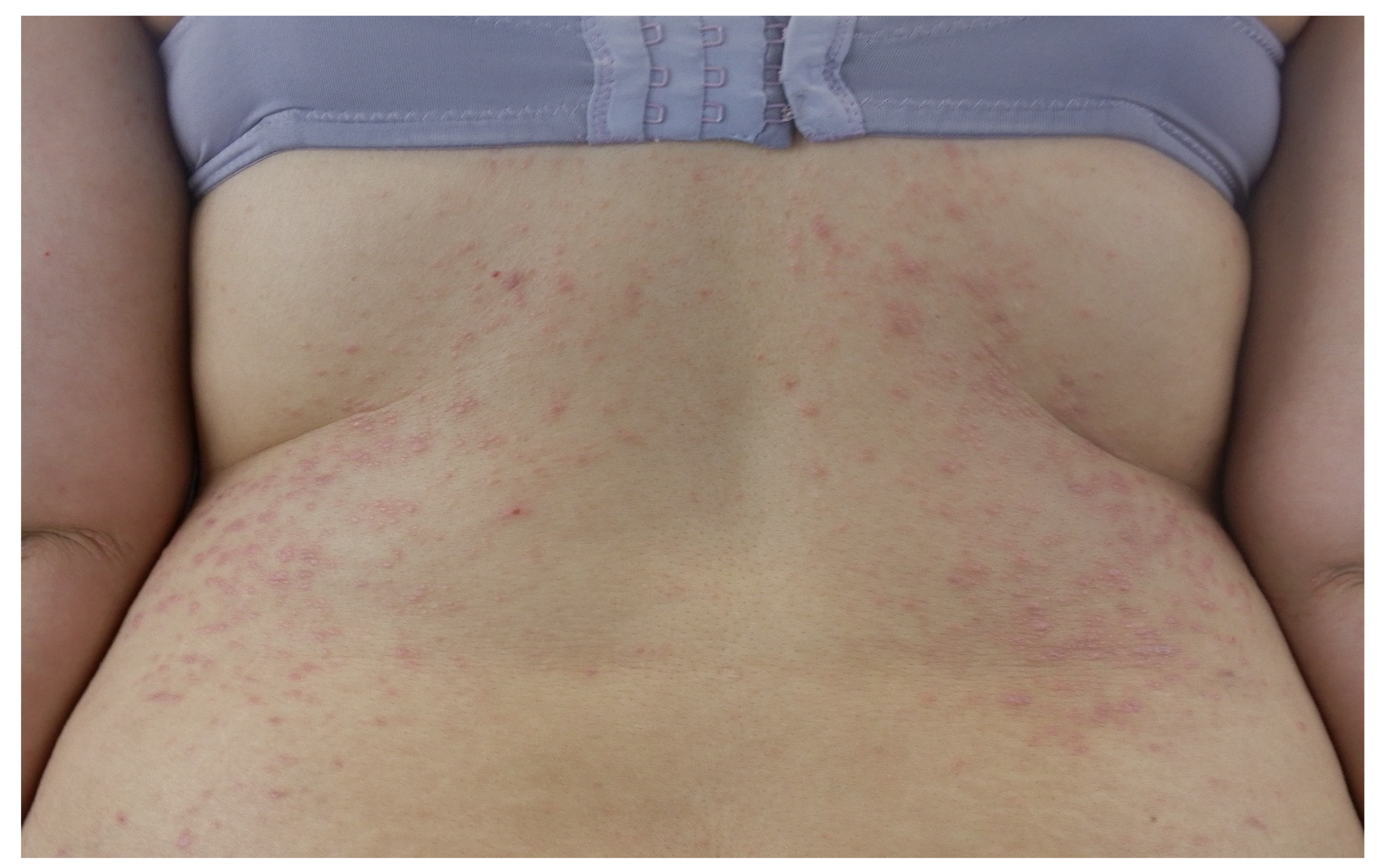 Medicina 61 01056 g002