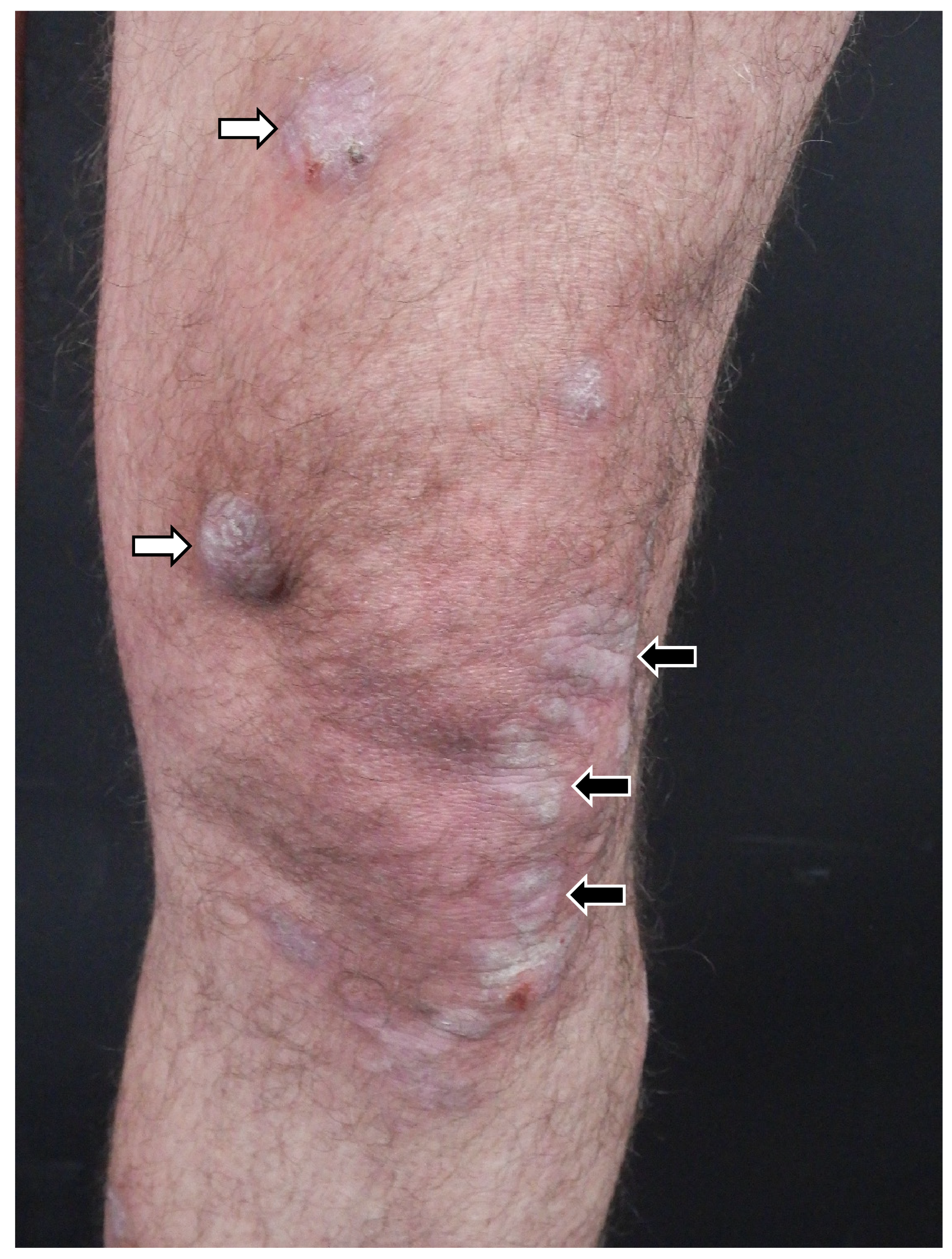 Medicina 61 01056 g003