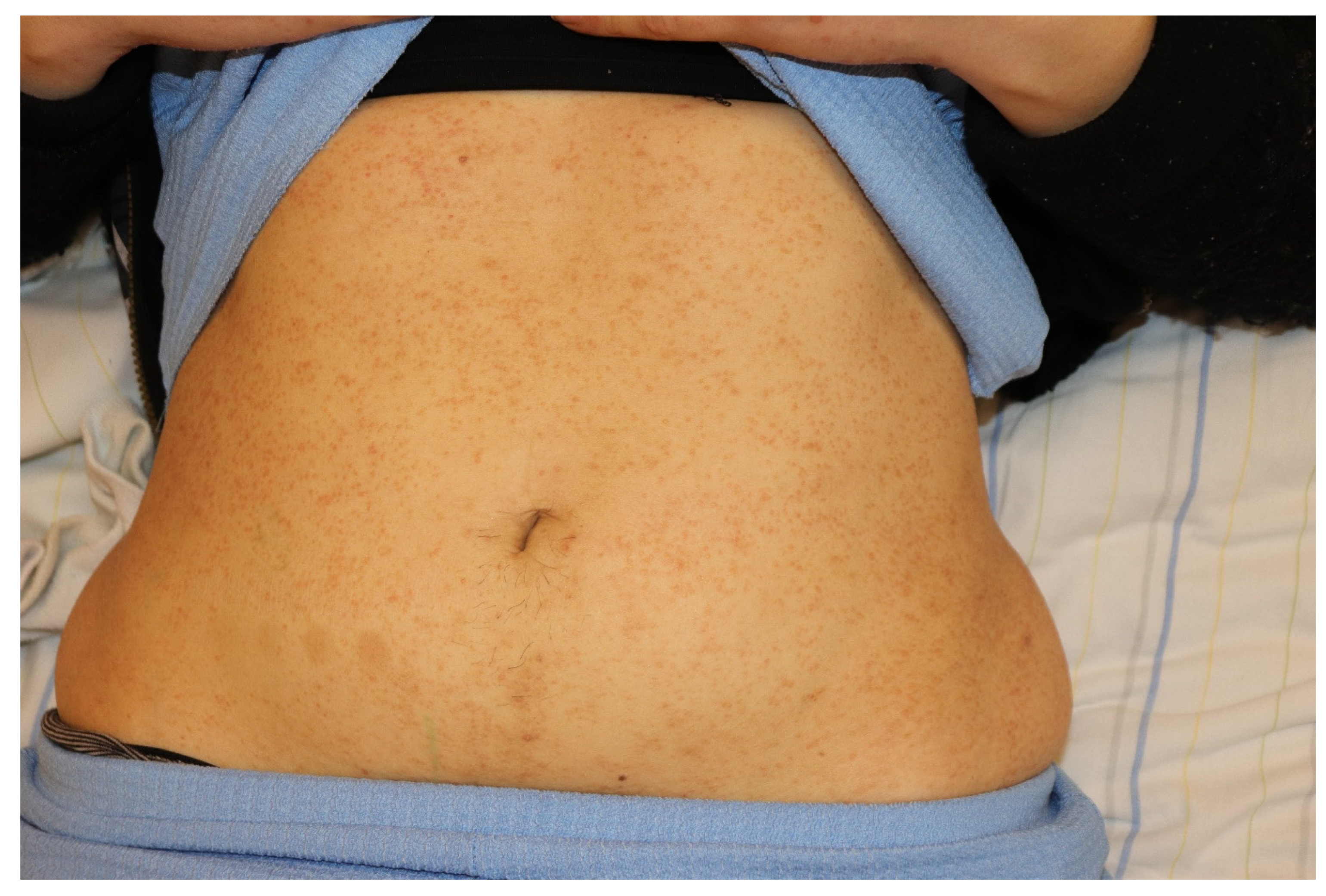 Medicina 61 01056 g004