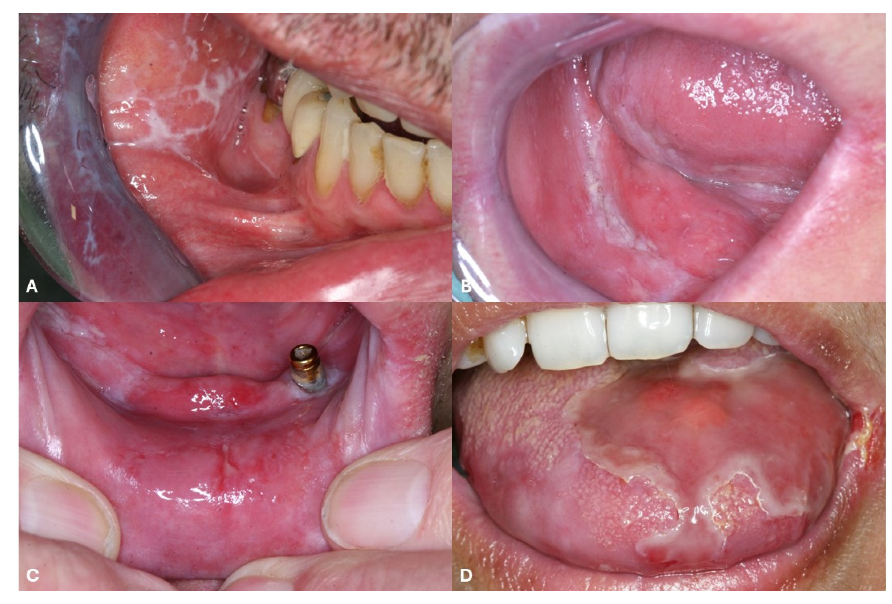 Medicina 61 01056 g005