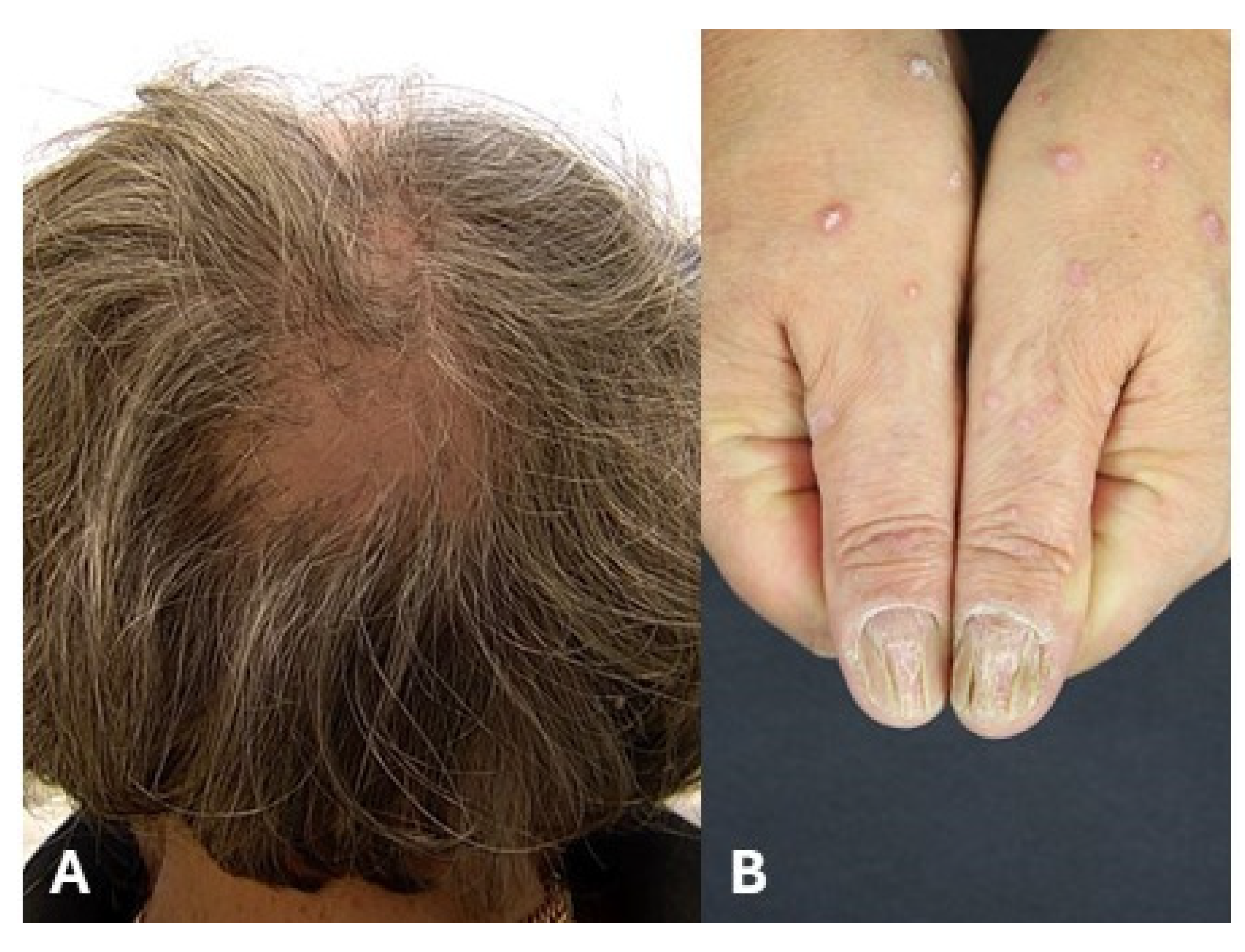 Medicina 61 01056 g006