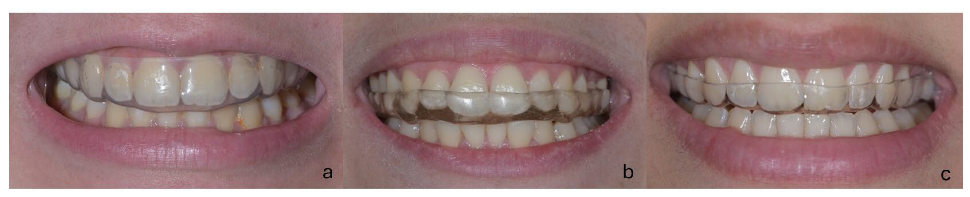 Medicina 61 01083 g002