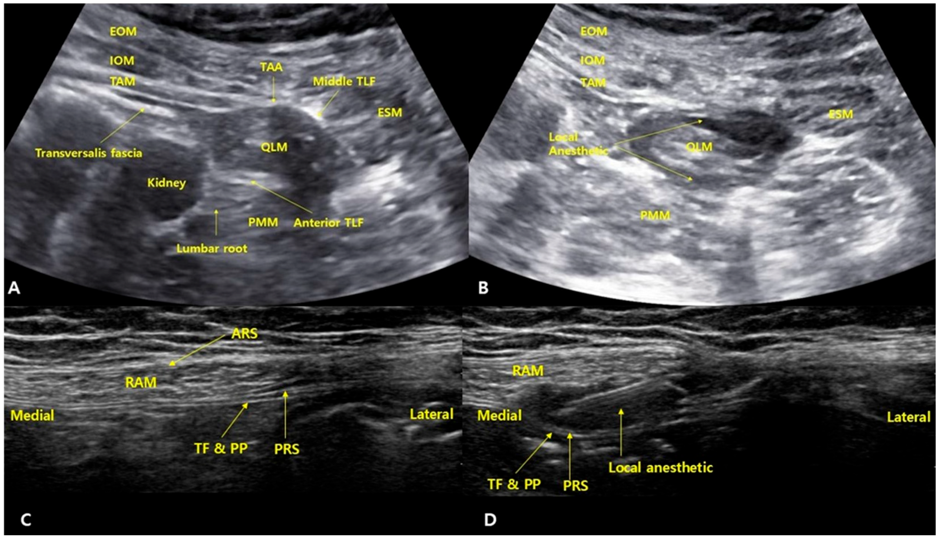 Medicina 61 01084 g001