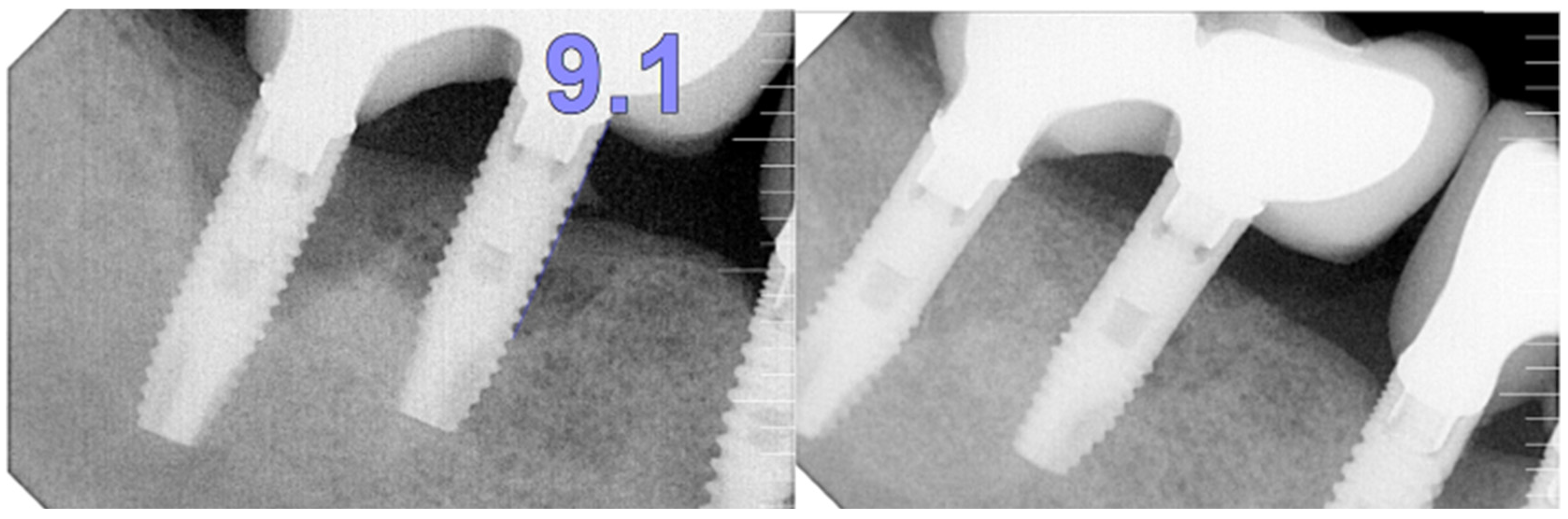 Medicina 61 01094 g005