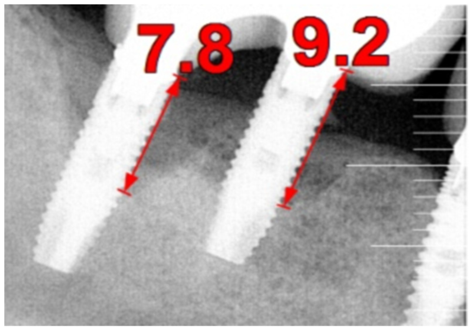 Medicina 61 01094 g007