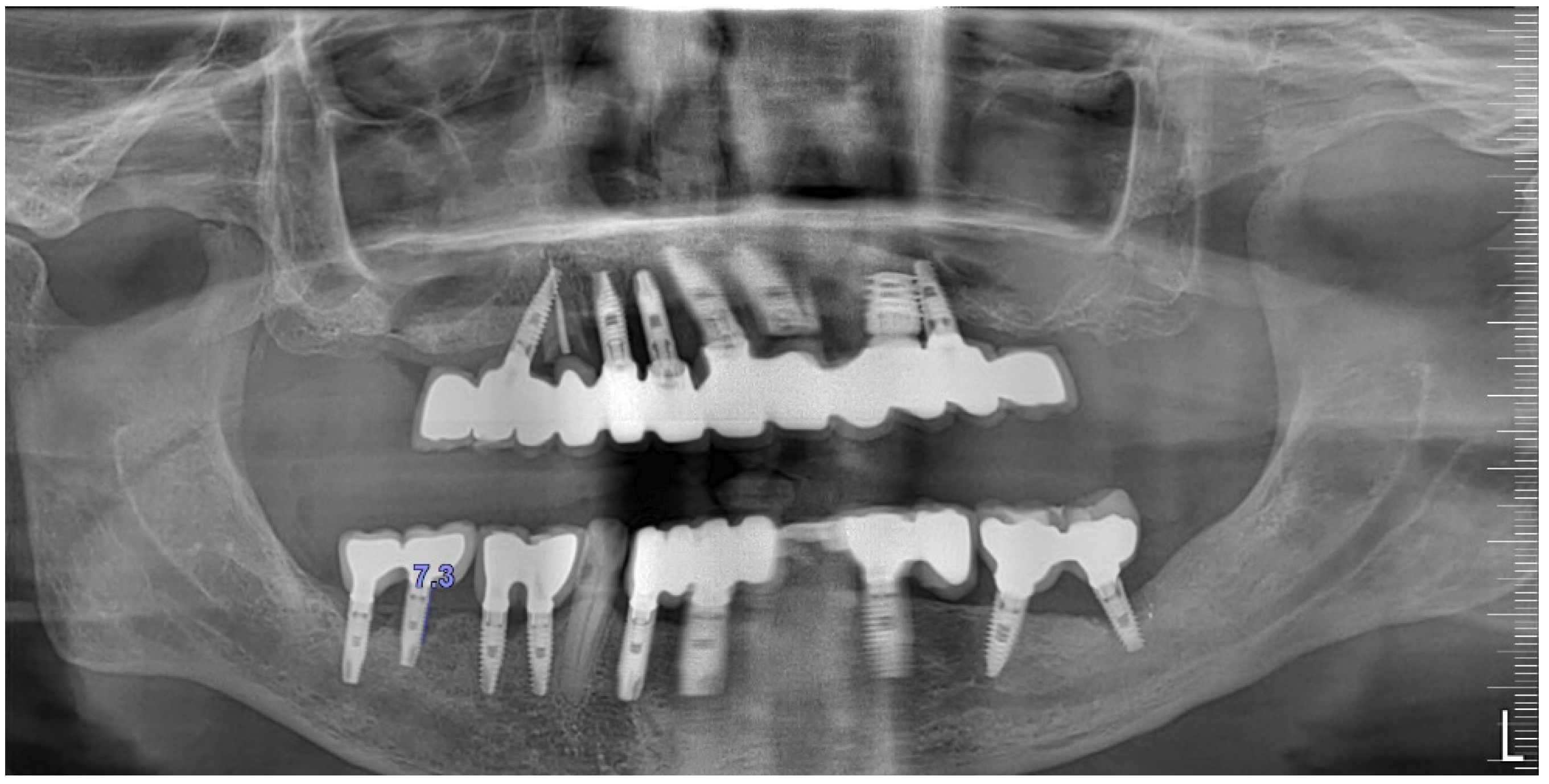 Medicina 61 01094 g008