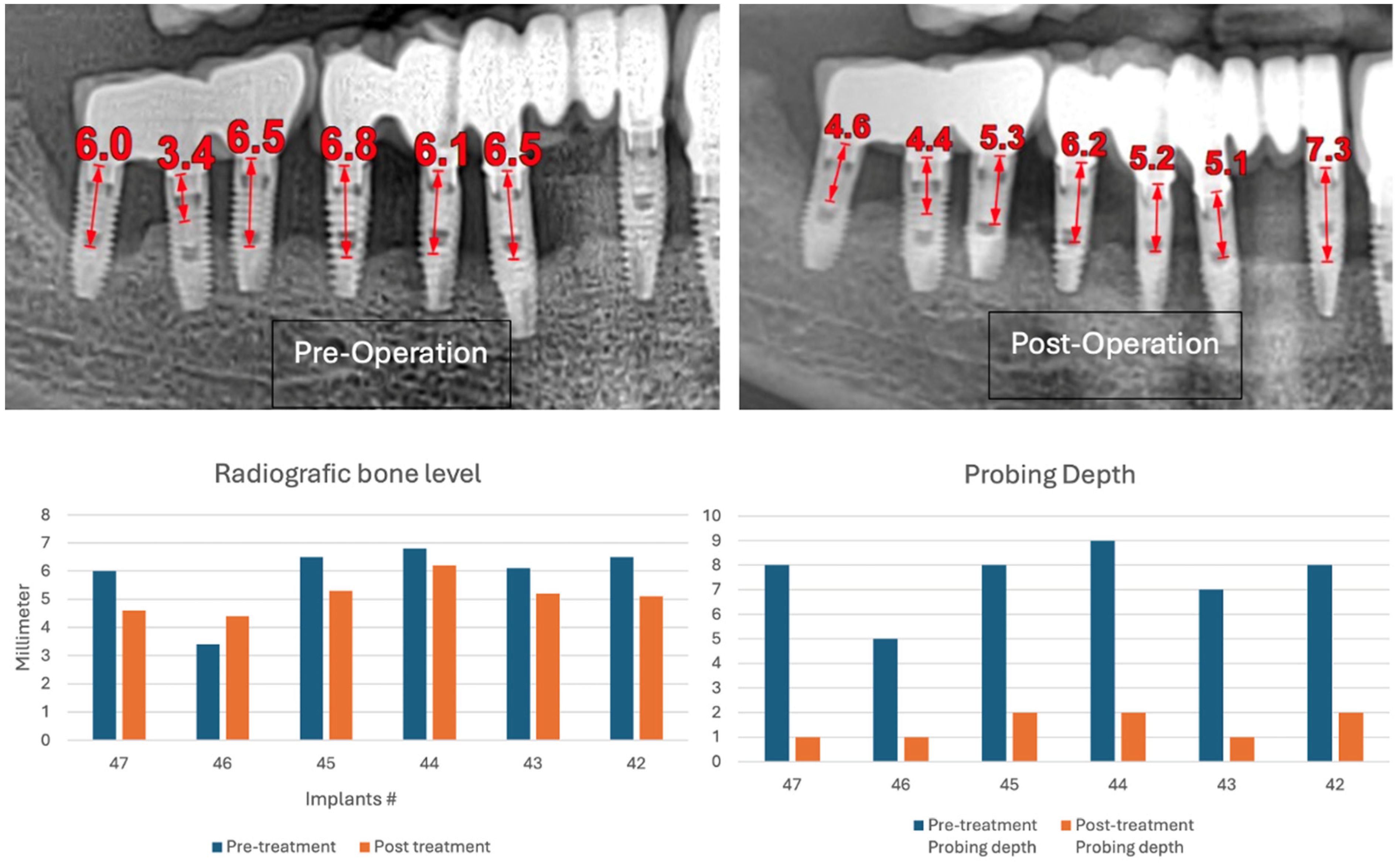 Medicina 61 01094 g023