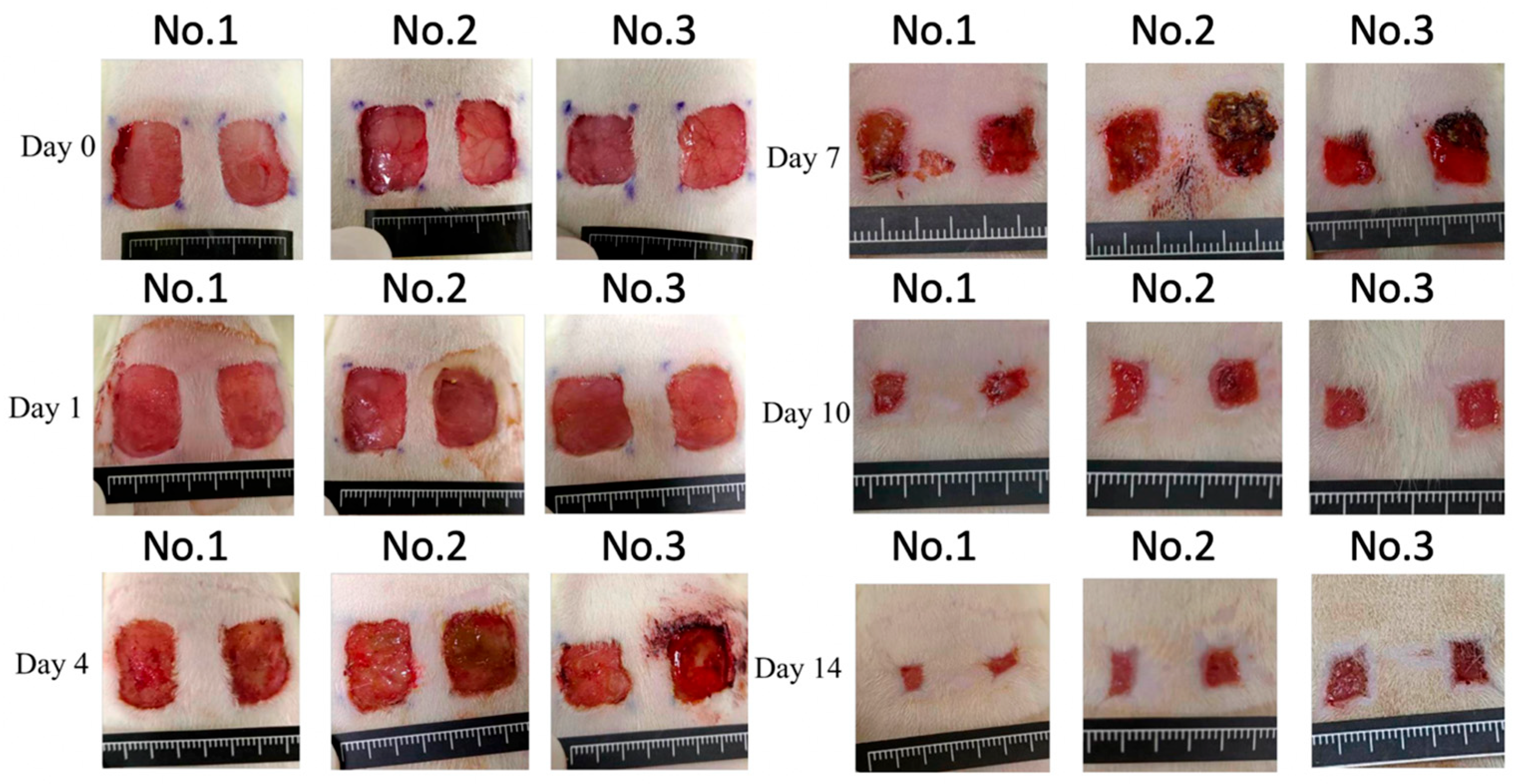 Medicina 61 01098 g002 Medicina 61 01098 g002