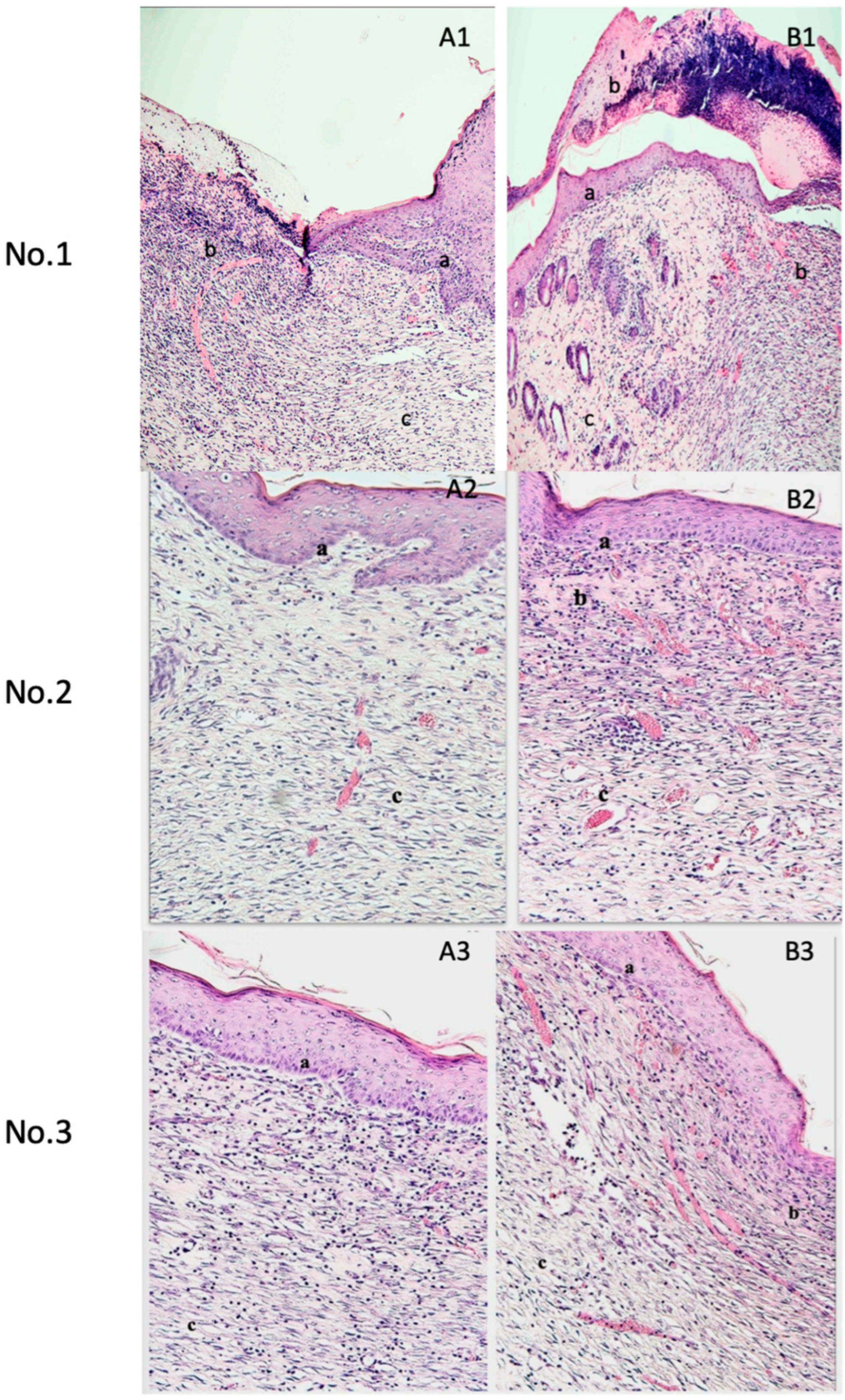 Medicina 61 01098 g003 Medicina 61 01098 g003