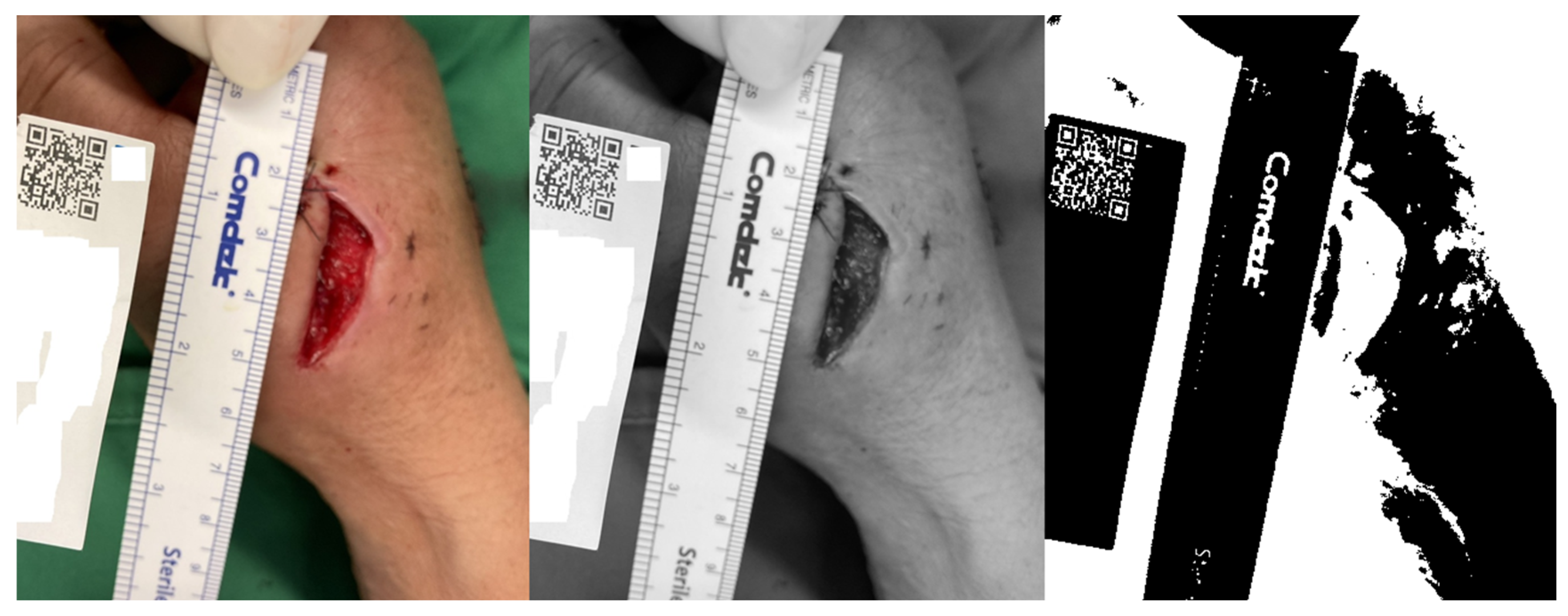 Medicina 61 01099 g002