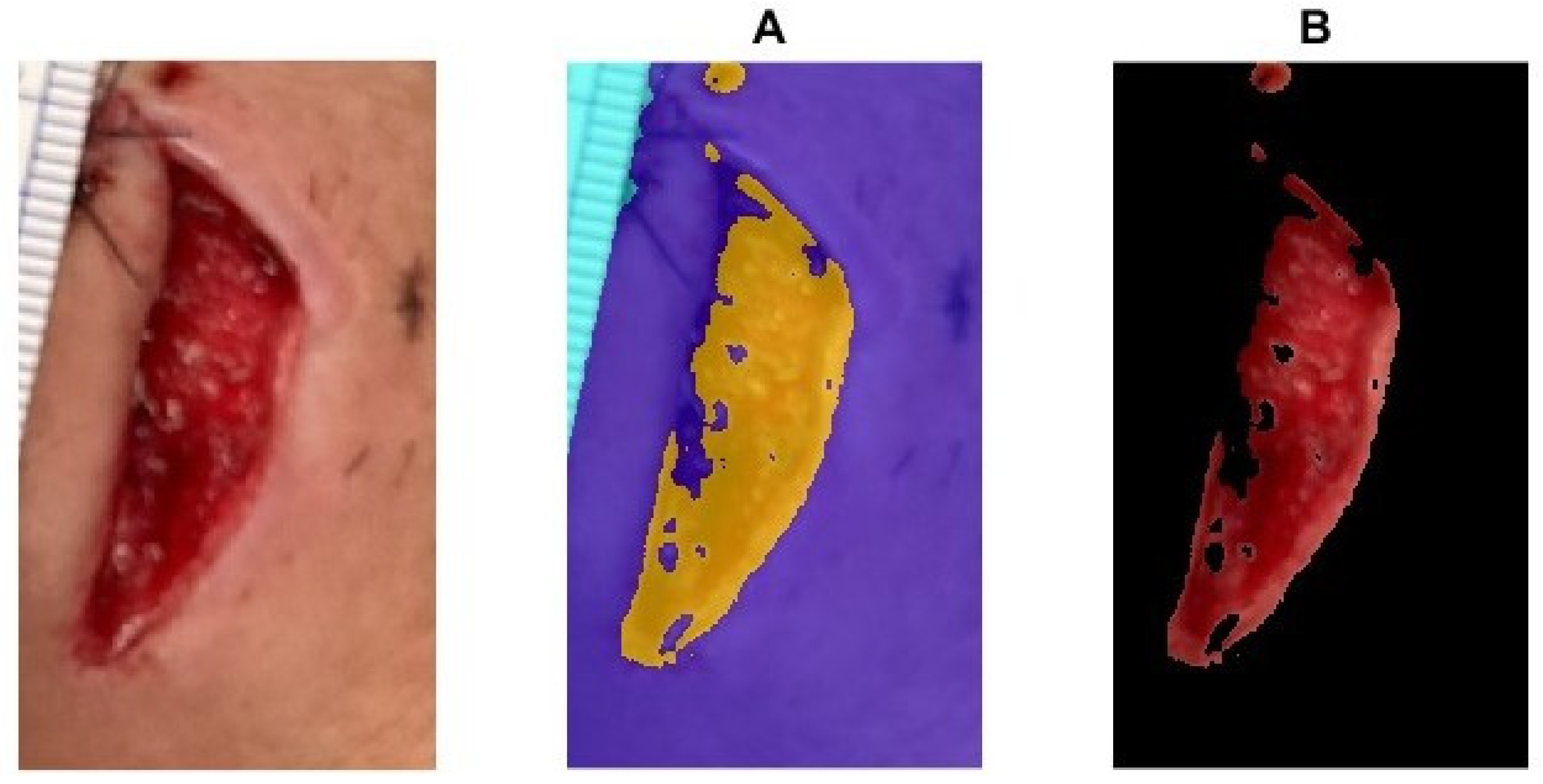 Medicina 61 01099 g005