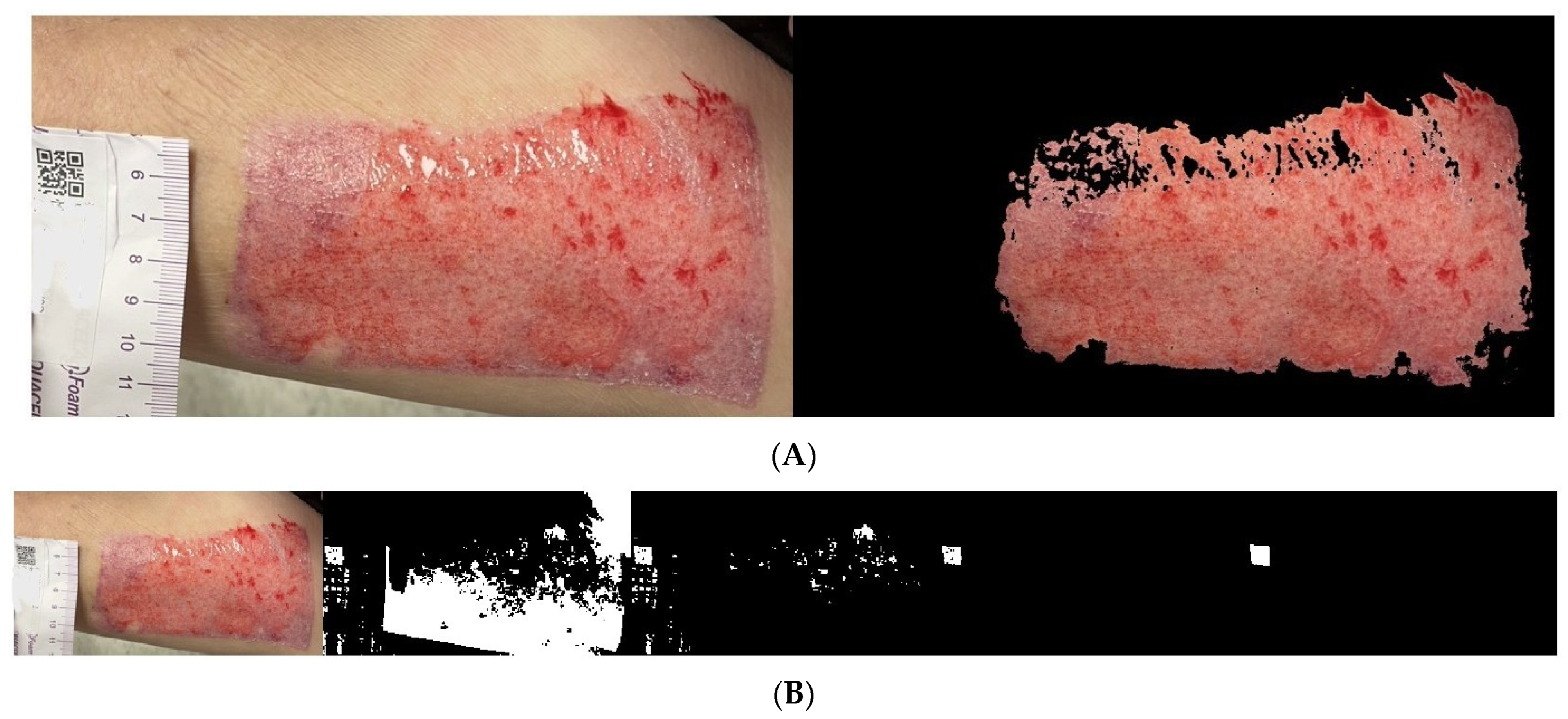 Medicina 61 01099 g008