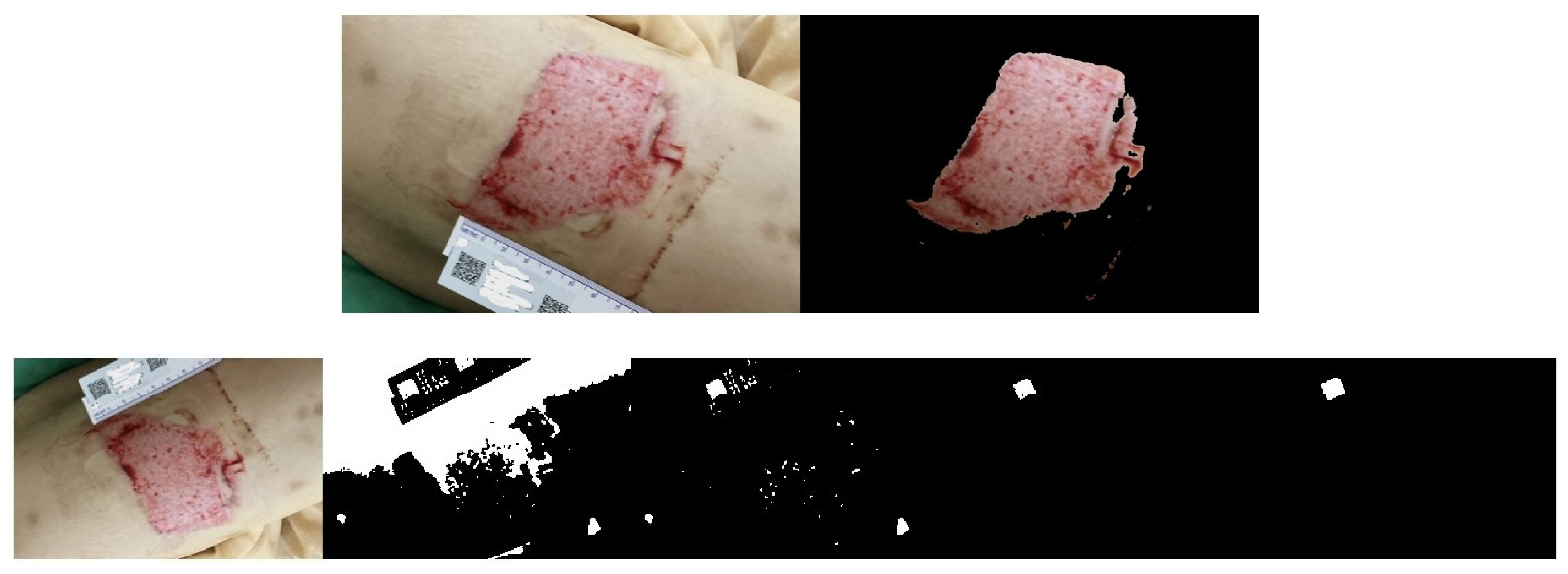 Medicina 61 01099 g011