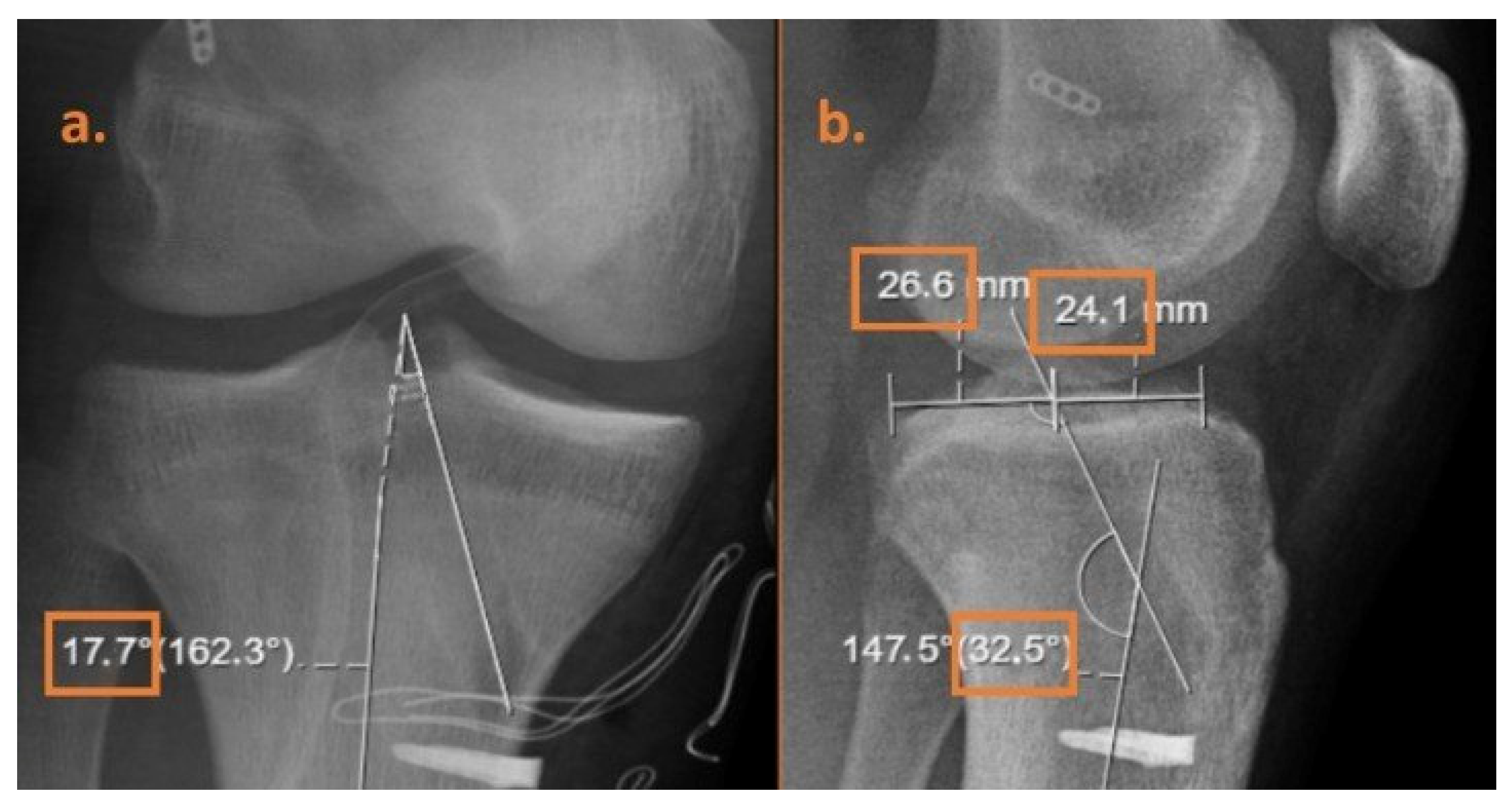 Medicina 61 01107 g001
