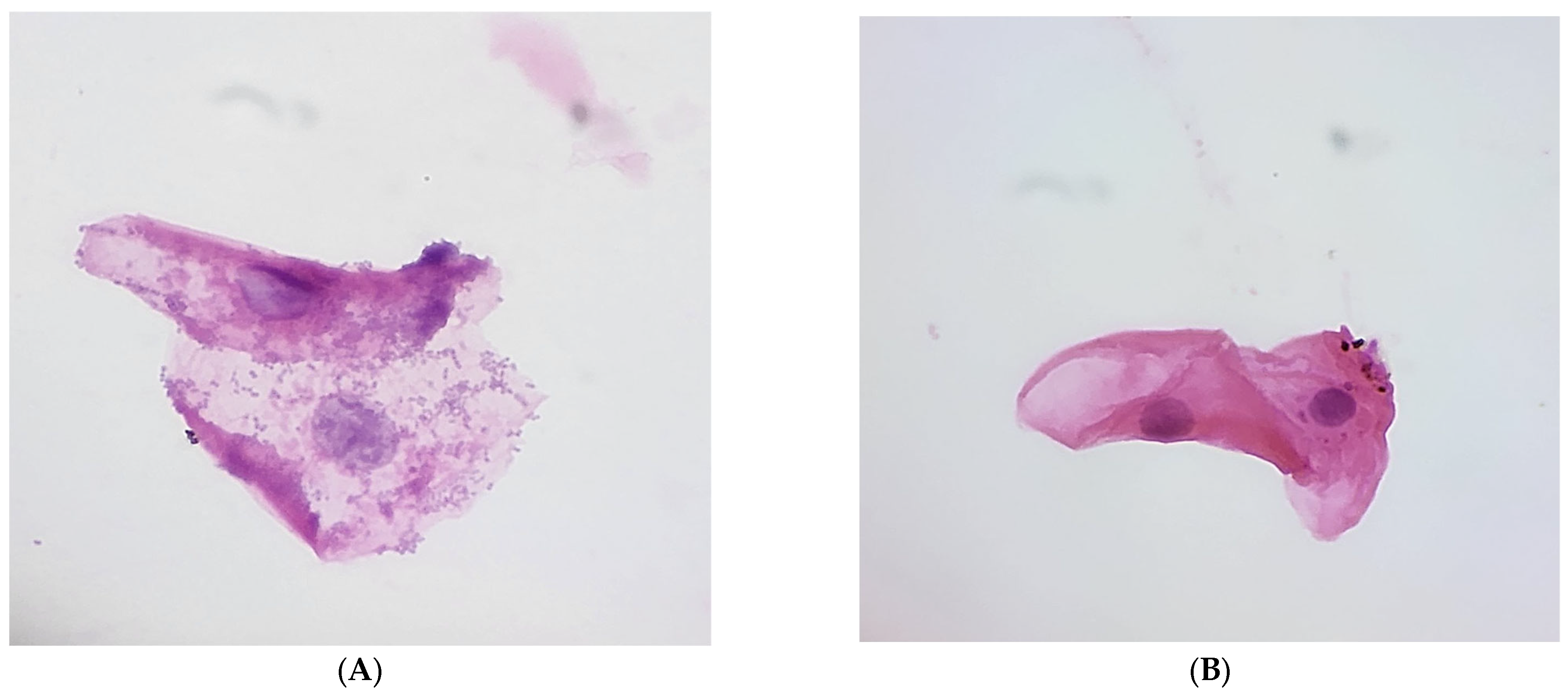 Medicina 61 01114 g002