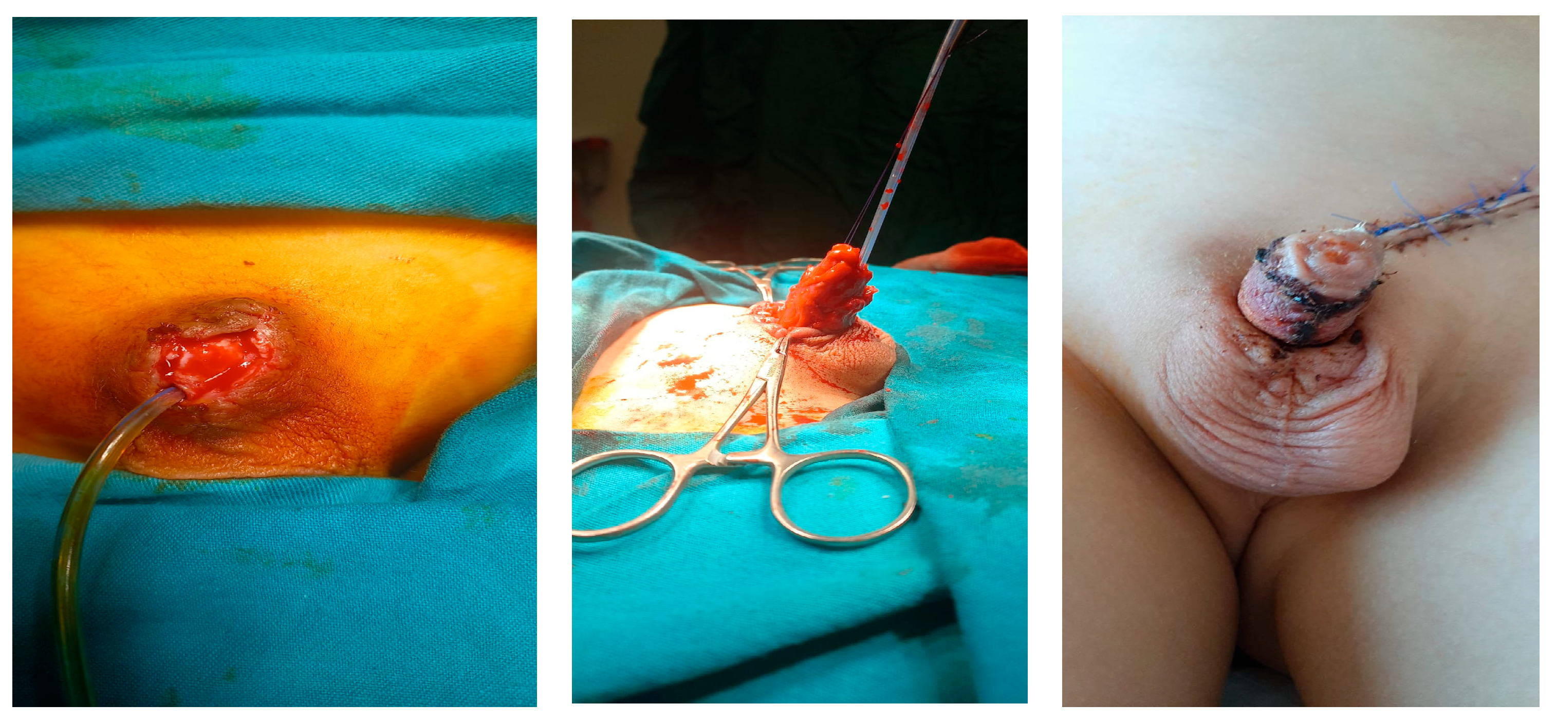 Medicina 61 01124 g001