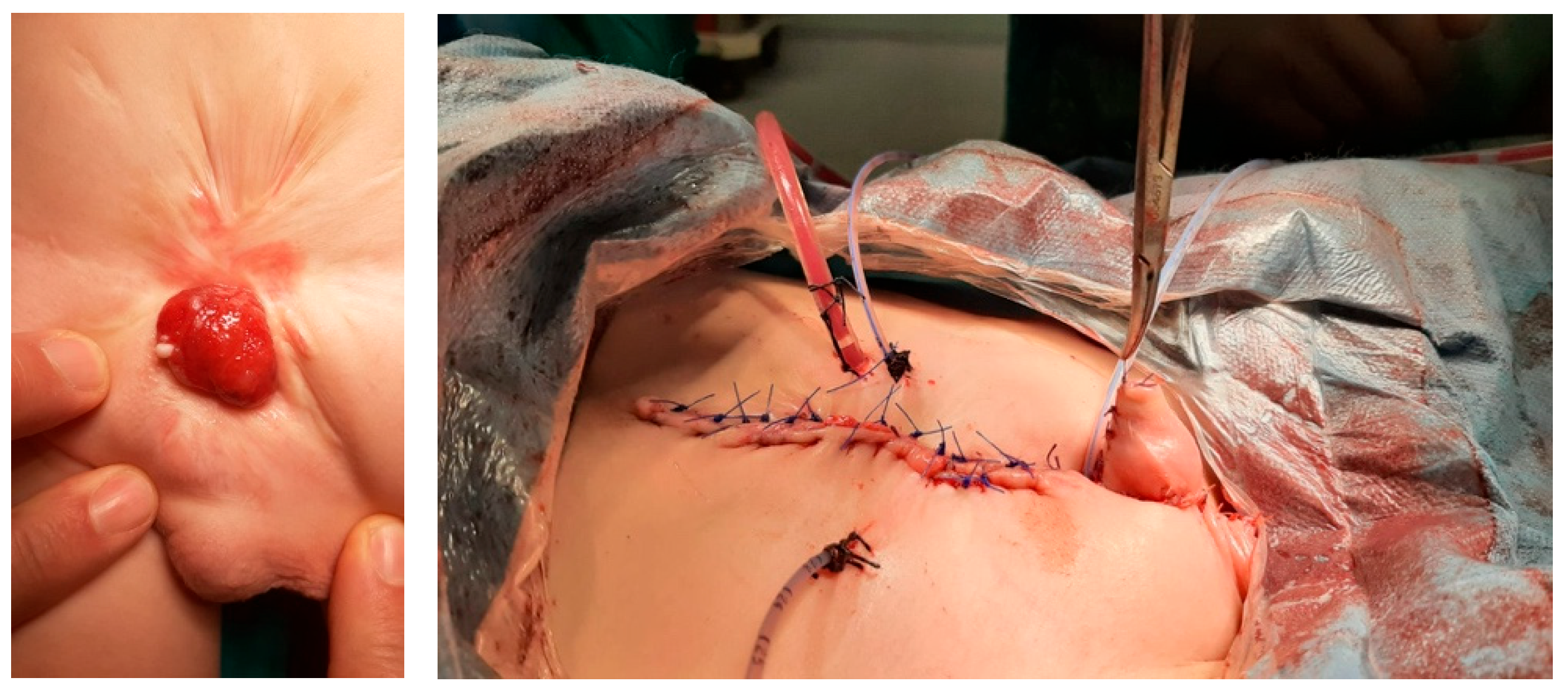 Medicina 61 01124 g002