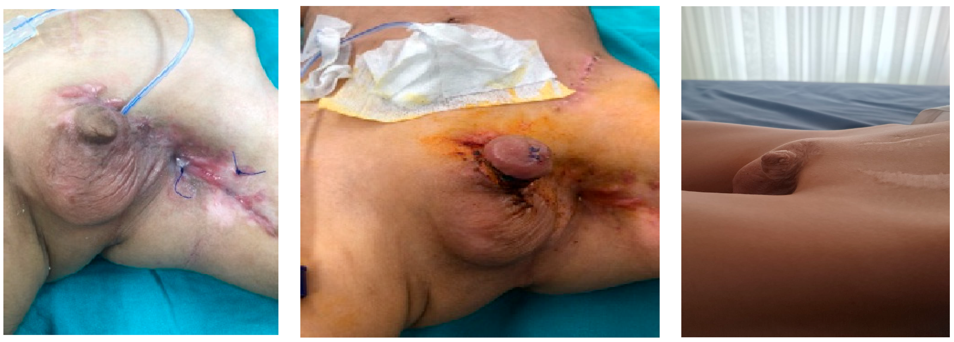 Medicina 61 01124 g003