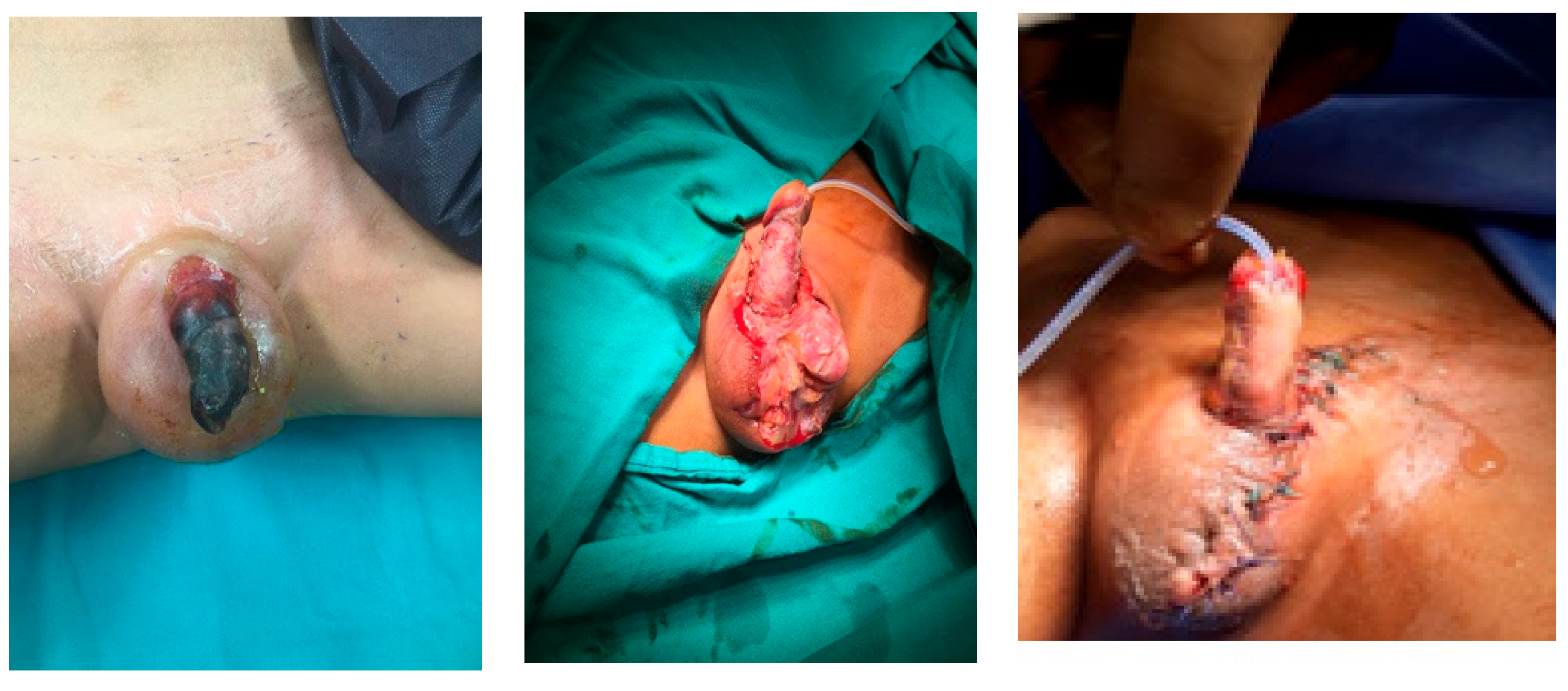 Medicina 61 01124 g004