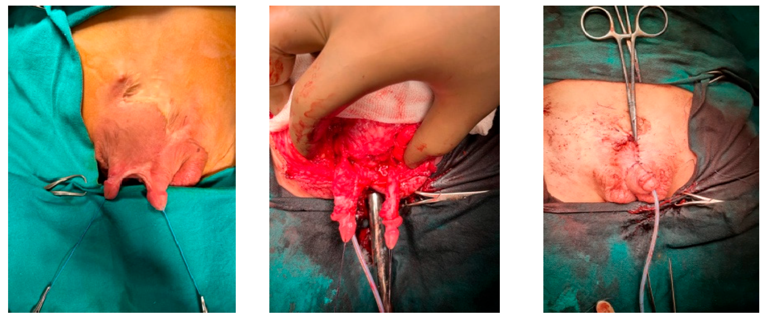 Medicina 61 01124 g005