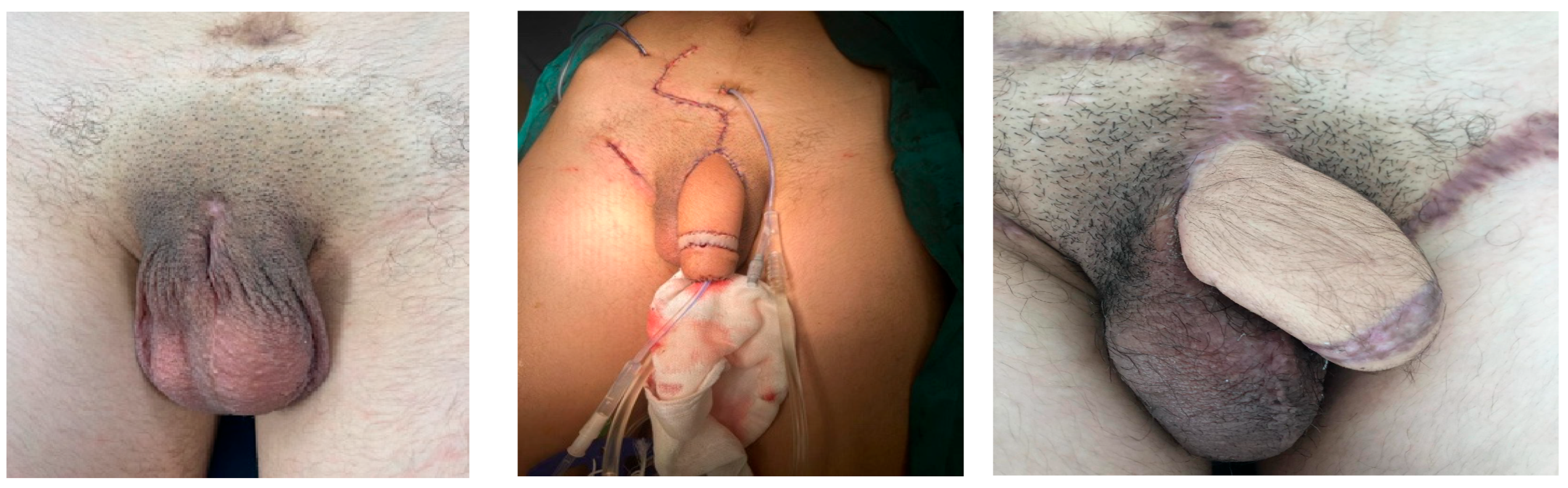 Medicina 61 01124 g006