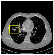 Medicina 61 01126 i005