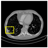 Medicina 61 01126 i007