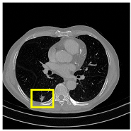 Medicina 61 01126 i009