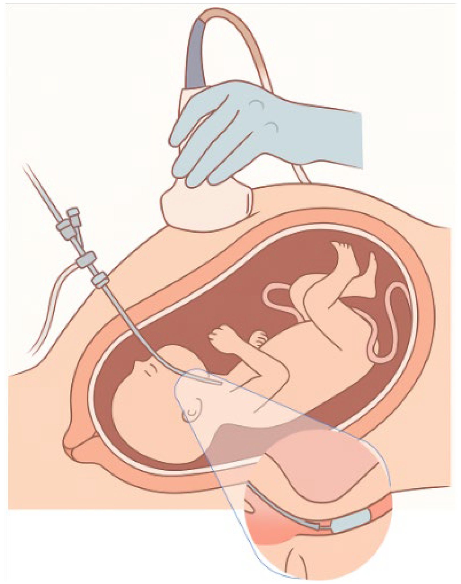 Medicina 61 01136 g002