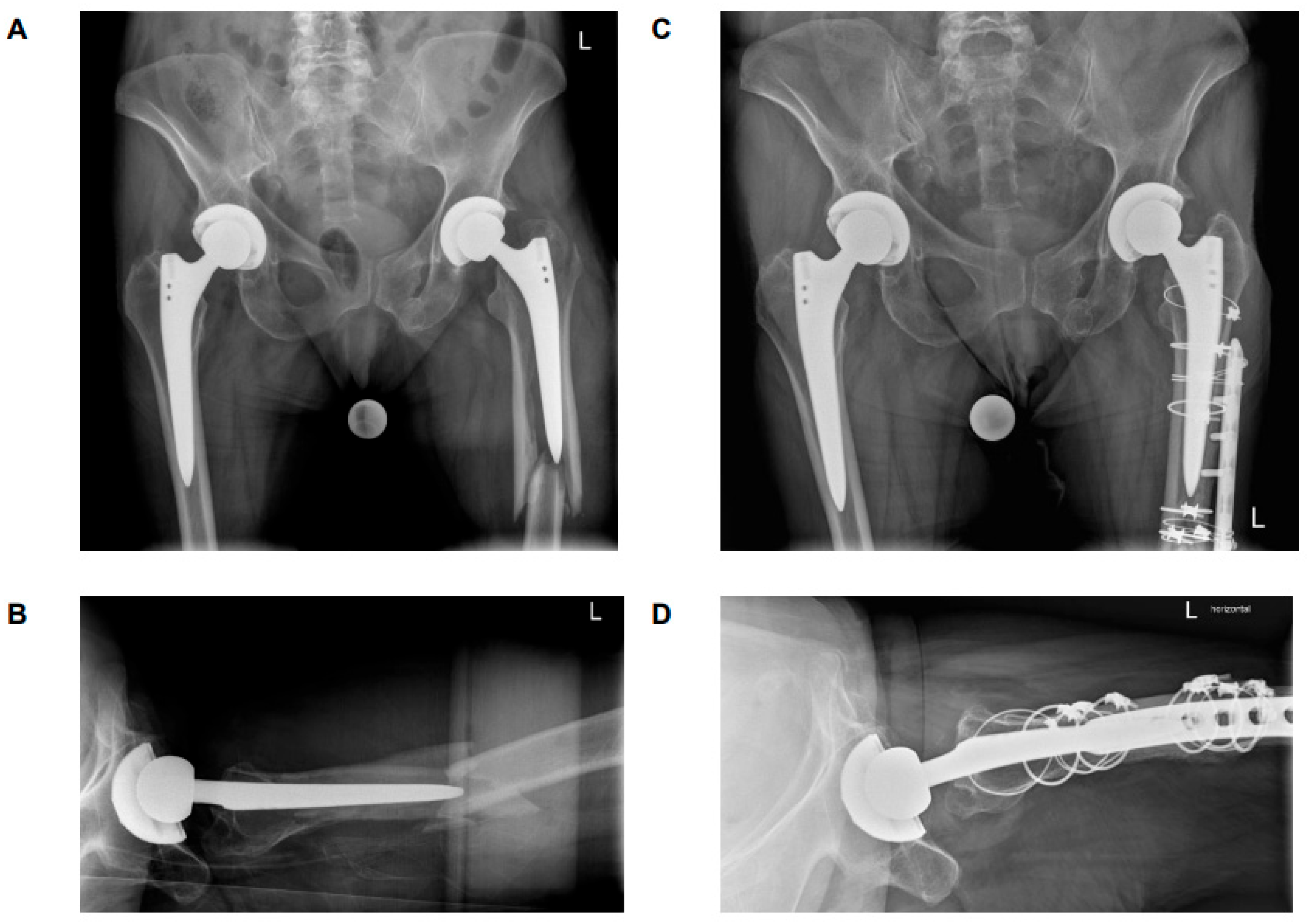 Medicina 61 01138 g003