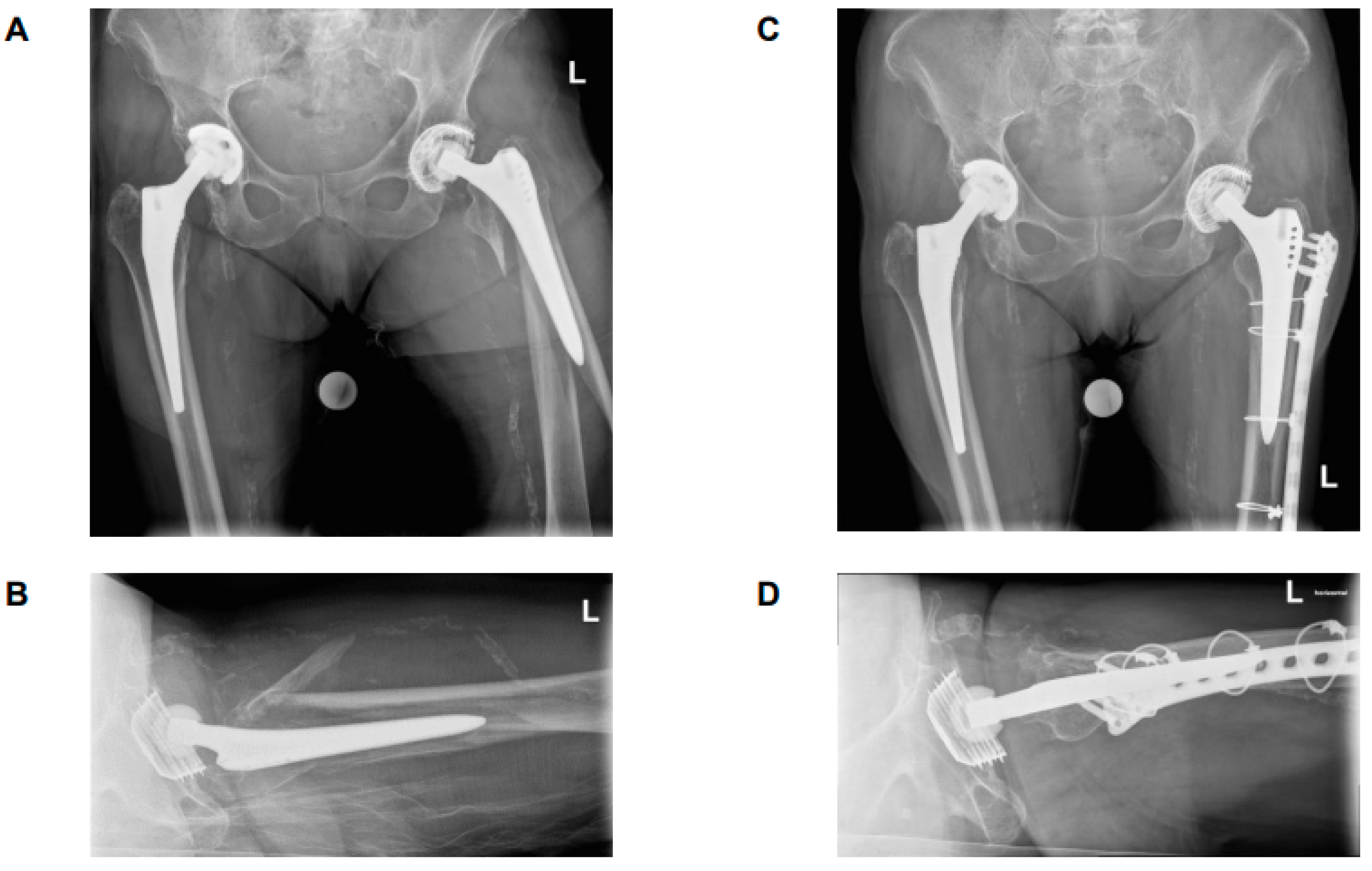 Medicina 61 01138 g004