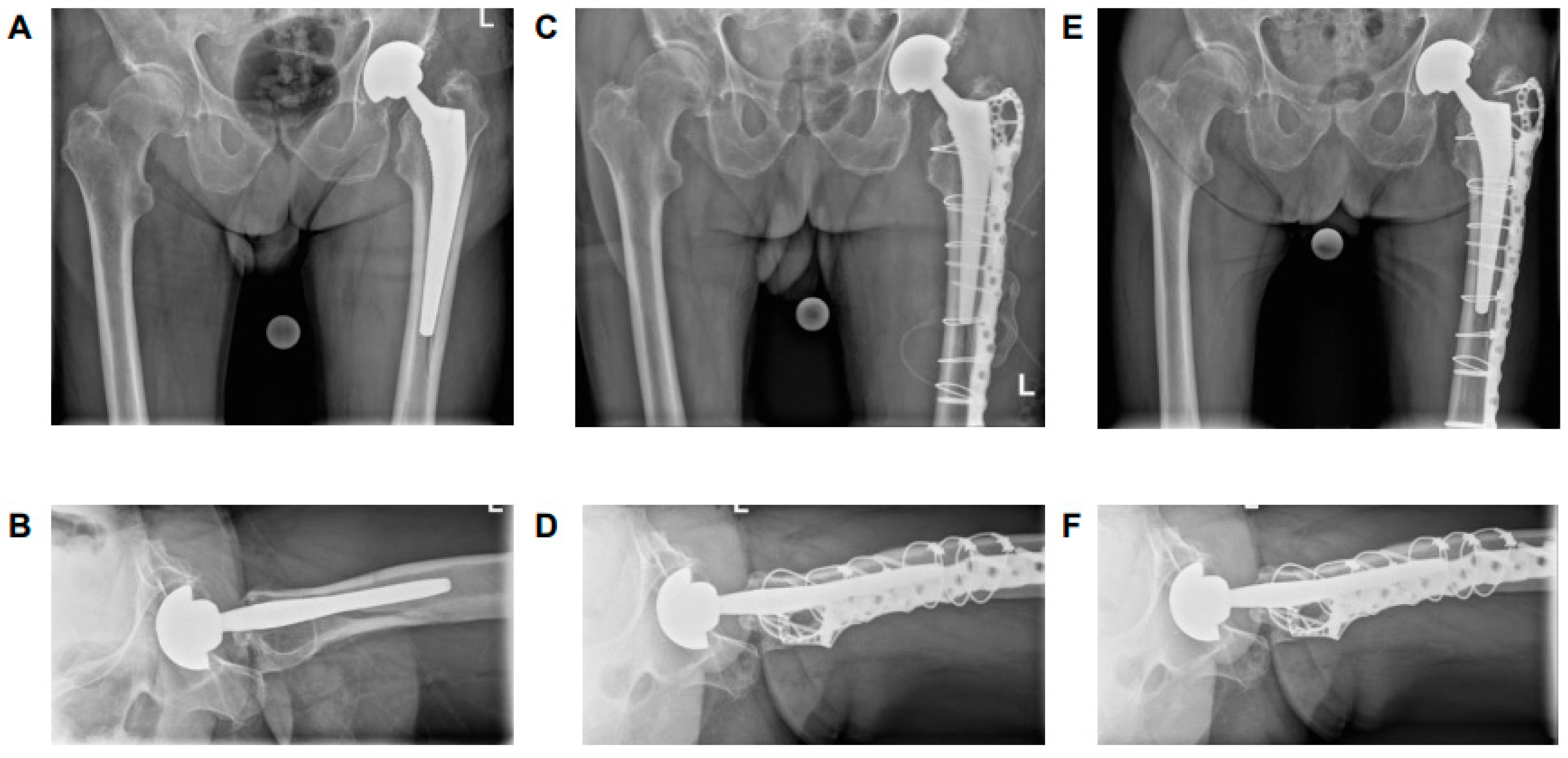Medicina 61 01138 g005