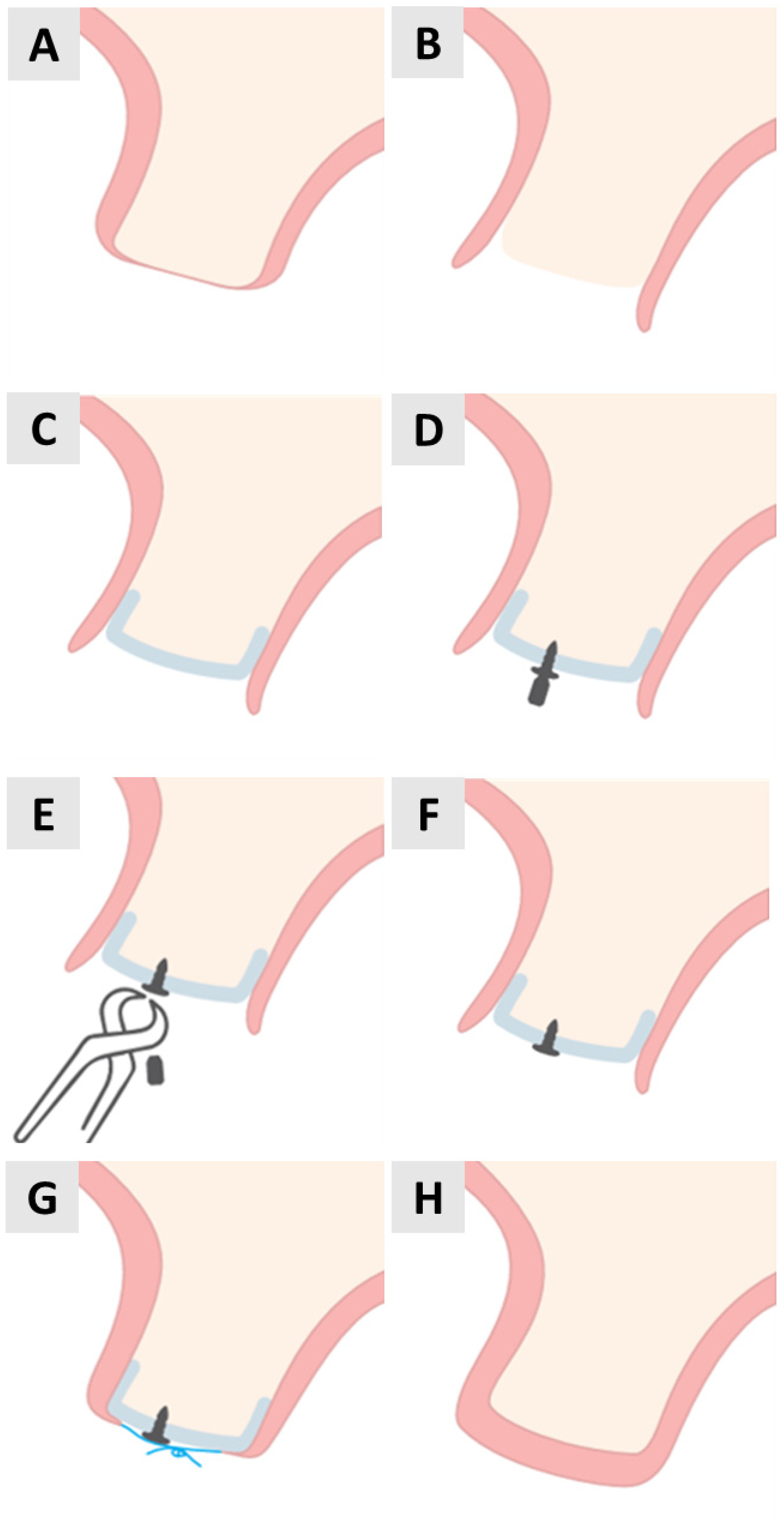 Medicina 61 01144 g001