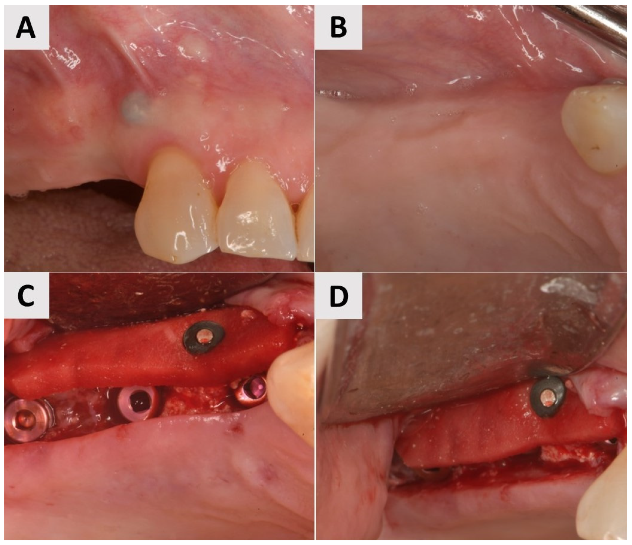 Medicina 61 01144 g002