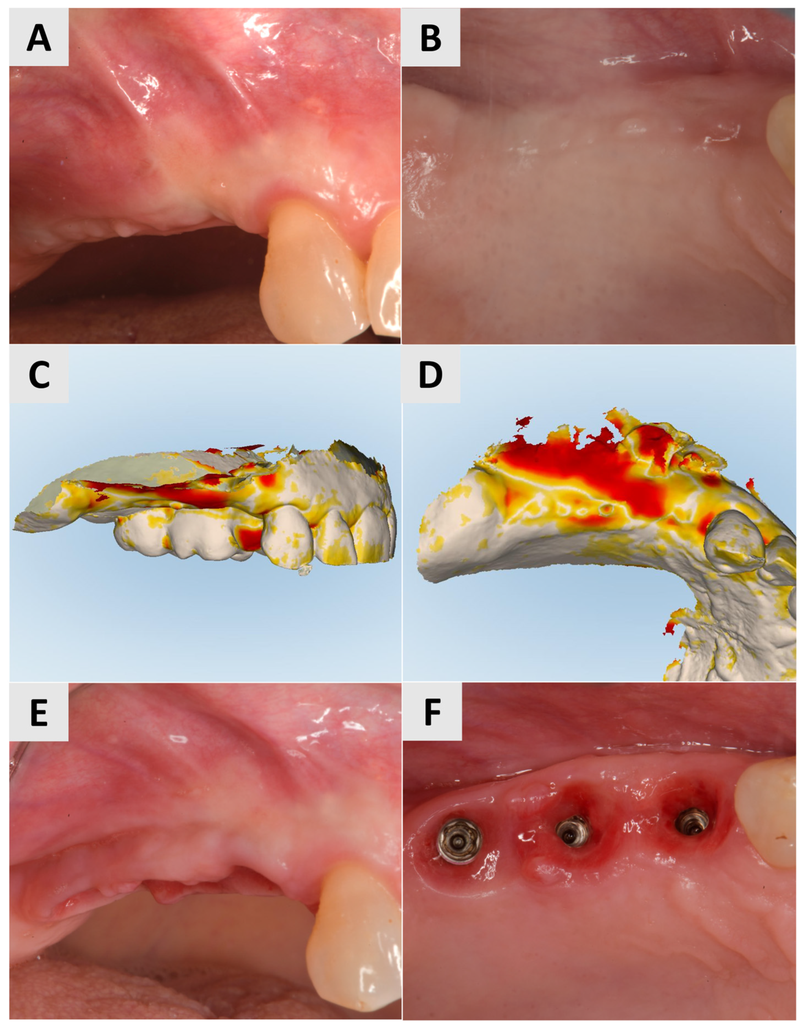 Medicina 61 01144 g003