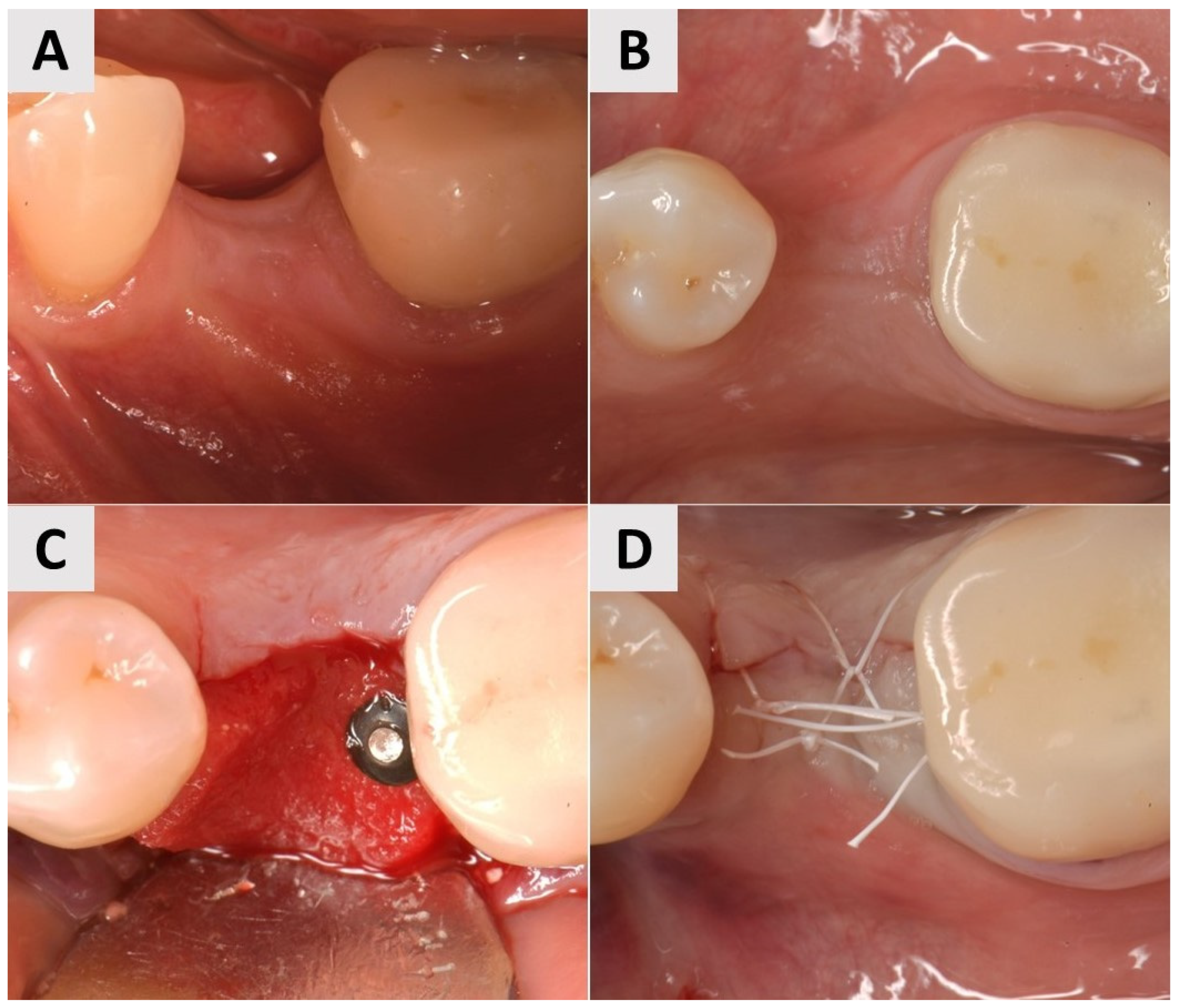 Medicina 61 01144 g004
