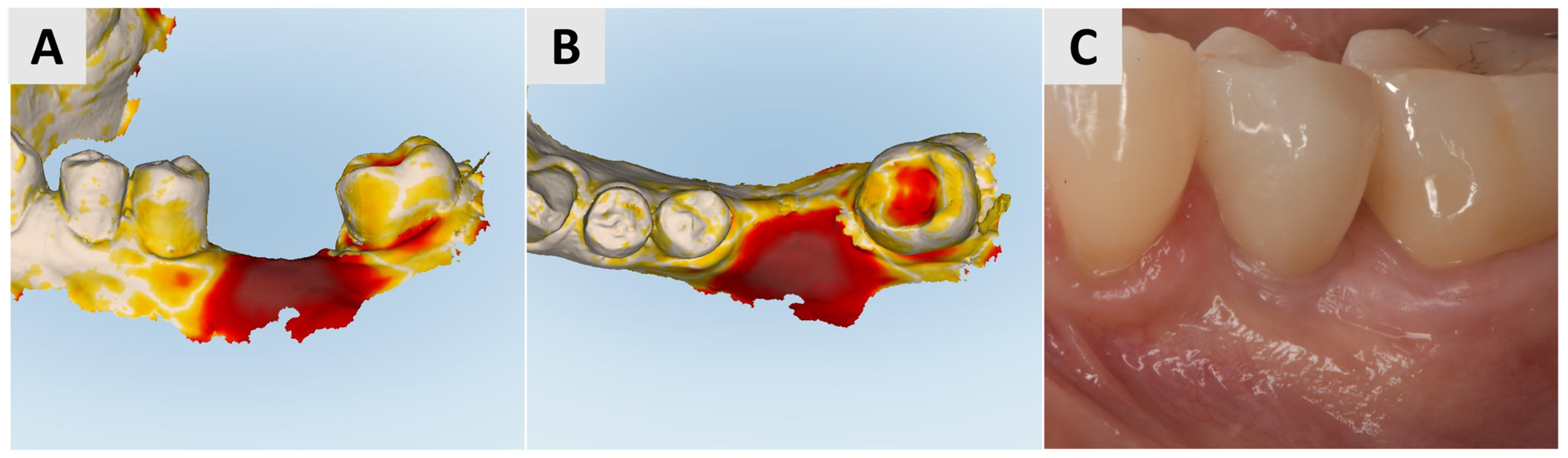 Medicina 61 01144 g005