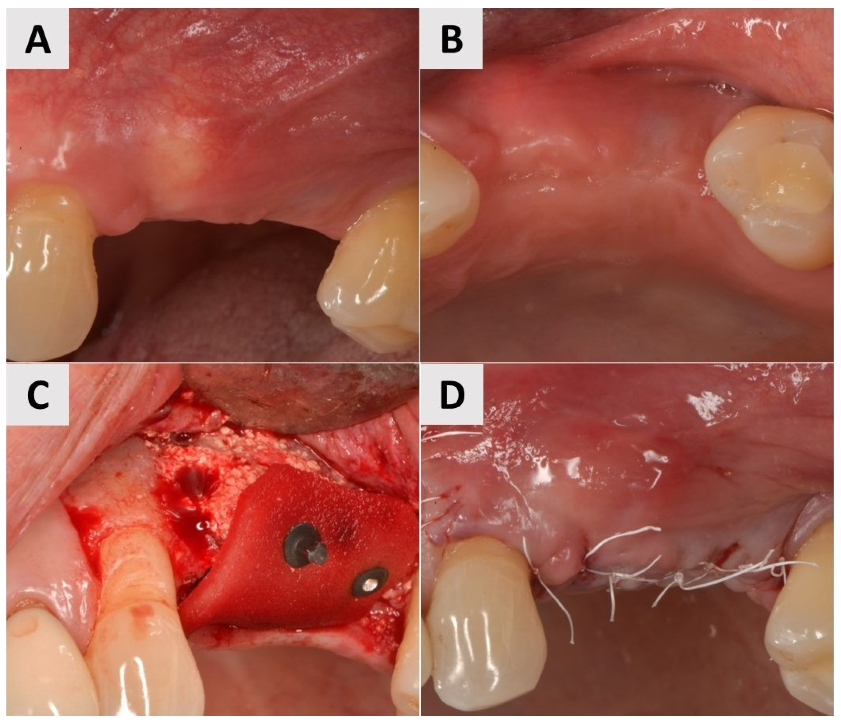 Medicina 61 01144 g006