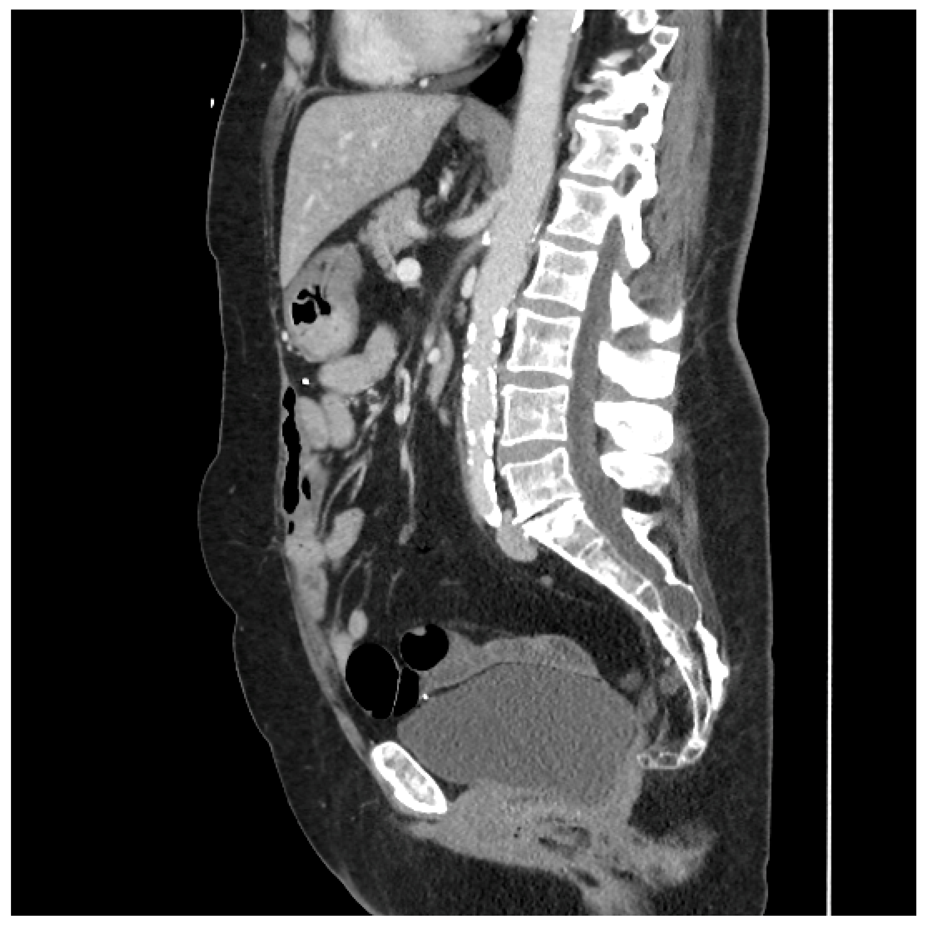 Medicina 61 01153 g002
